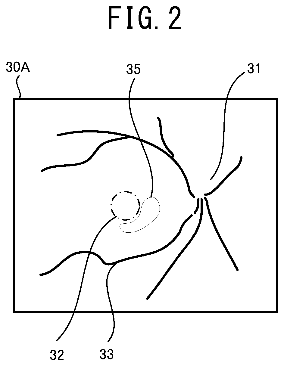 Patent US12096981 Figure 2 – Ophthalmologic image processing device and non-transitory computer-readable storage medium storing computer-readable instructions