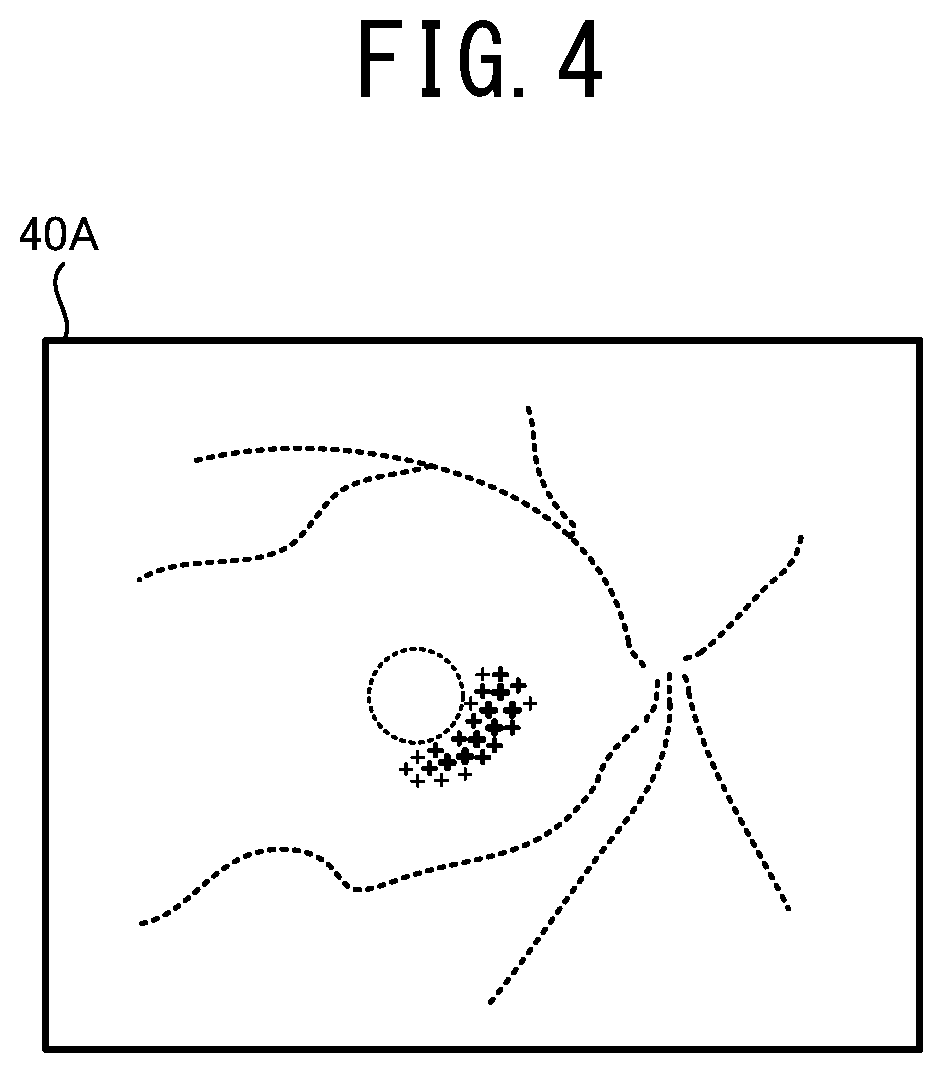 Patent US12096981 Figure 4 – Ophthalmologic image processing device and non-transitory computer-readable storage medium storing computer-readable instructions