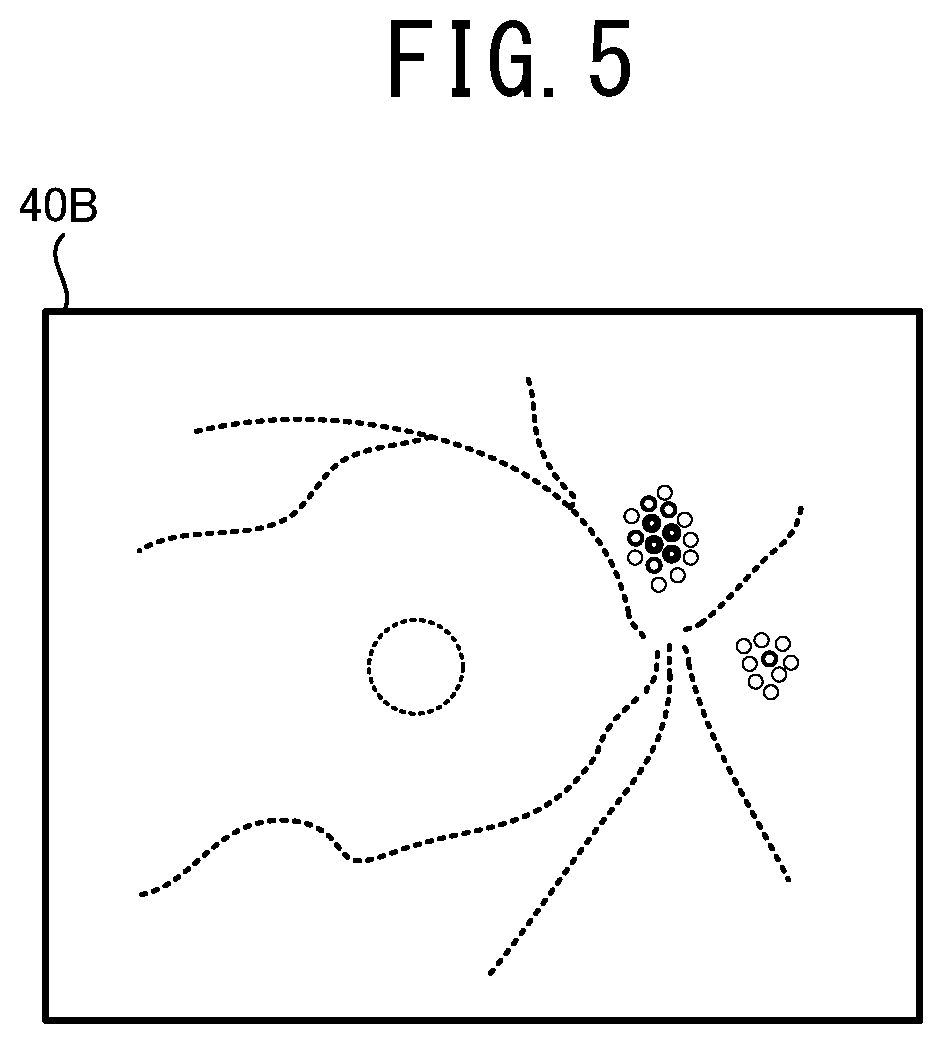 Patent US12096981 Figure 5 – Ophthalmologic image processing device and non-transitory computer-readable storage medium storing computer-readable instructions