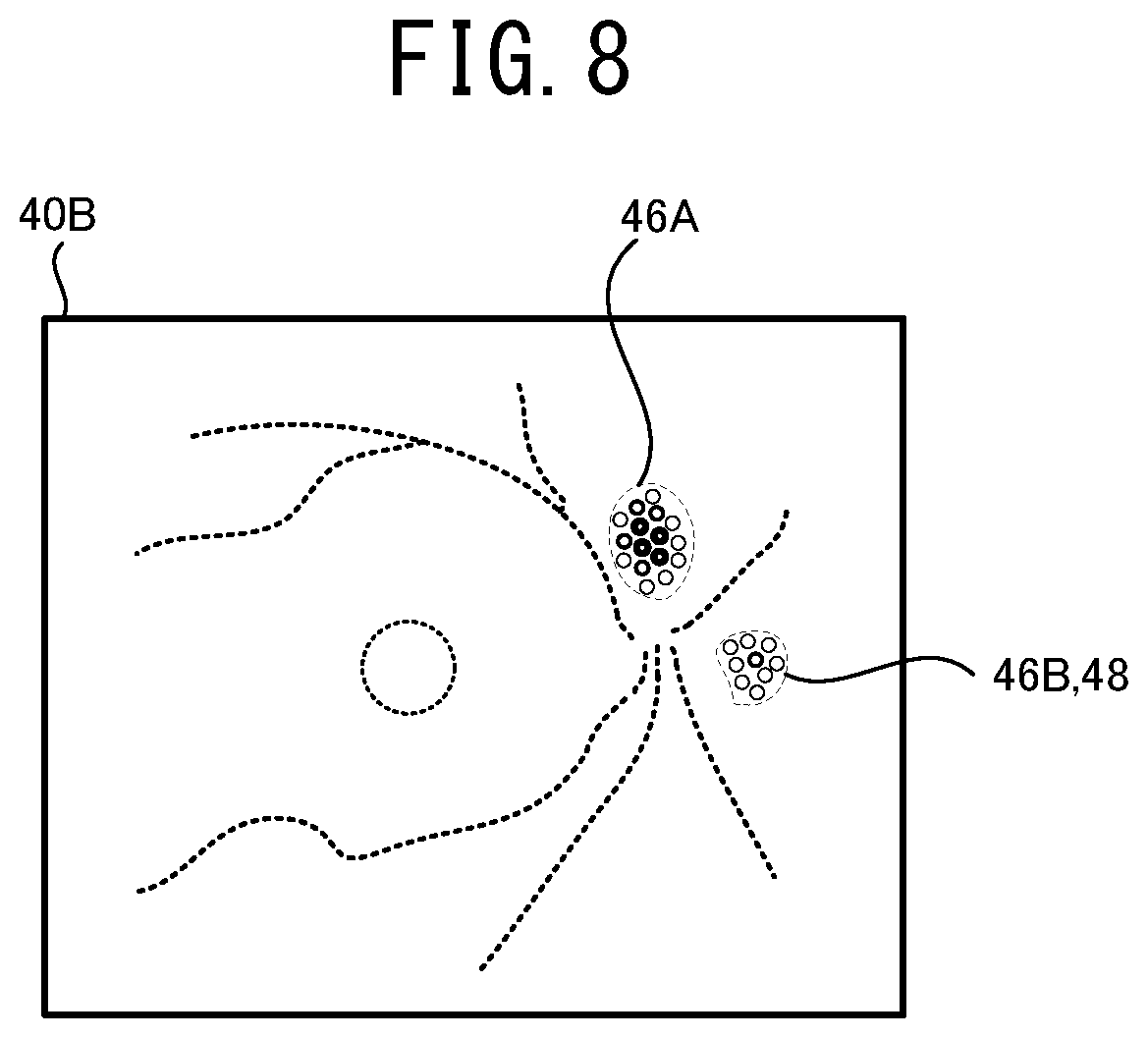 Patent US12096981 Figure 8 – Ophthalmologic image processing device and non-transitory computer-readable storage medium storing computer-readable instructions