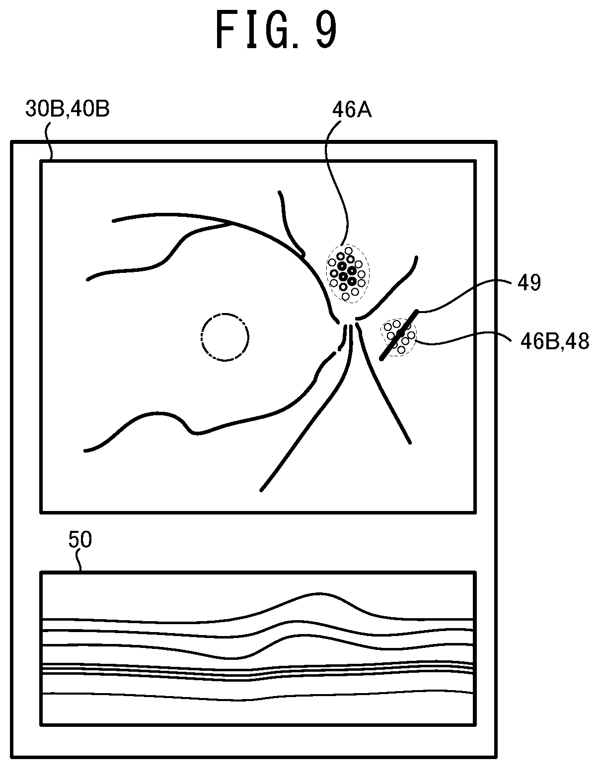 Patent US12096981 Figure 9 – Ophthalmologic image processing device and non-transitory computer-readable storage medium storing computer-readable instructions