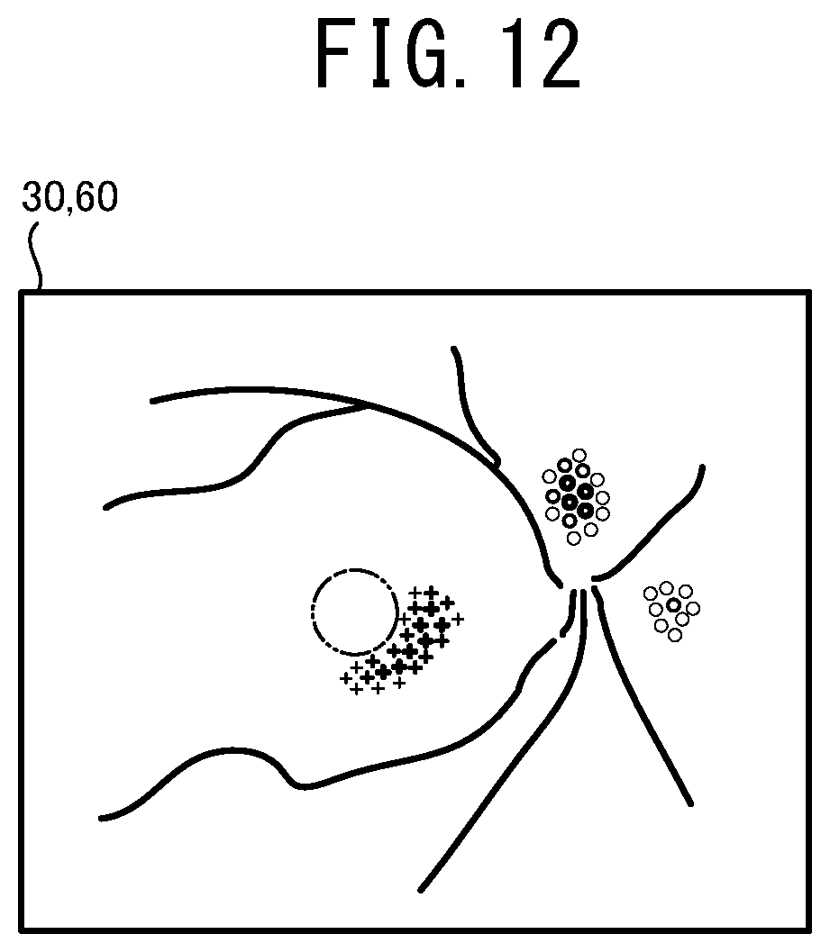 Patent US12096981 Figure 12 – Ophthalmologic image processing device and non-transitory computer-readable storage medium storing computer-readable instructions