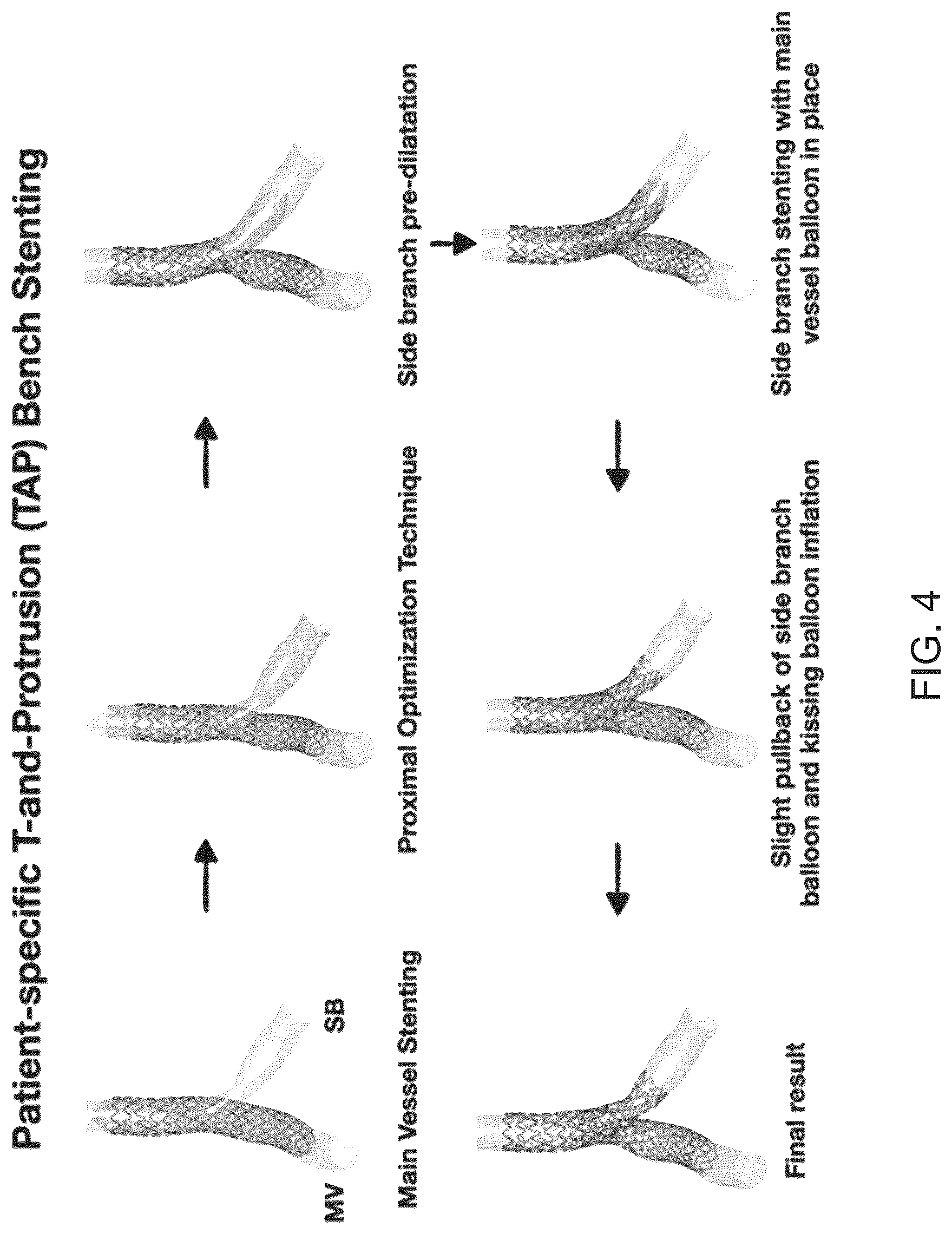 Patent US12096986 Figure 4 – Computational simulation platform for planning of interventional procedures