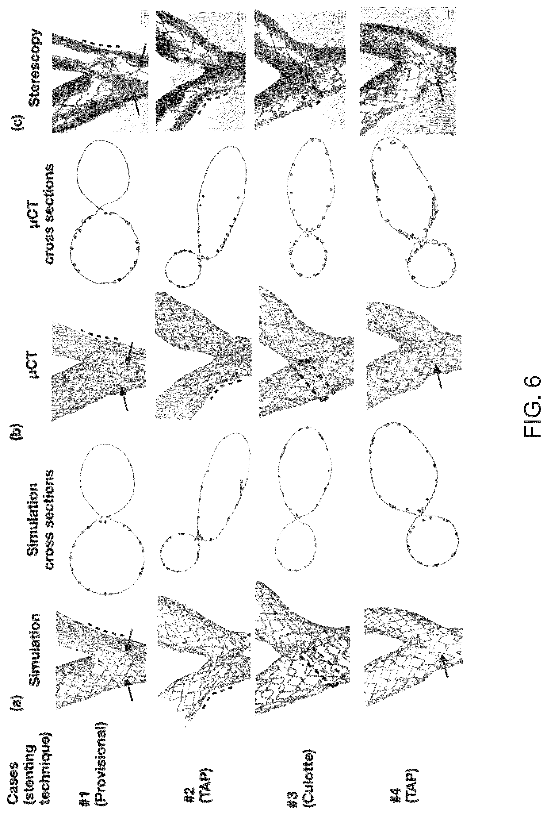Patent US12096986 Figure 6 – Computational simulation platform for planning of interventional procedures
