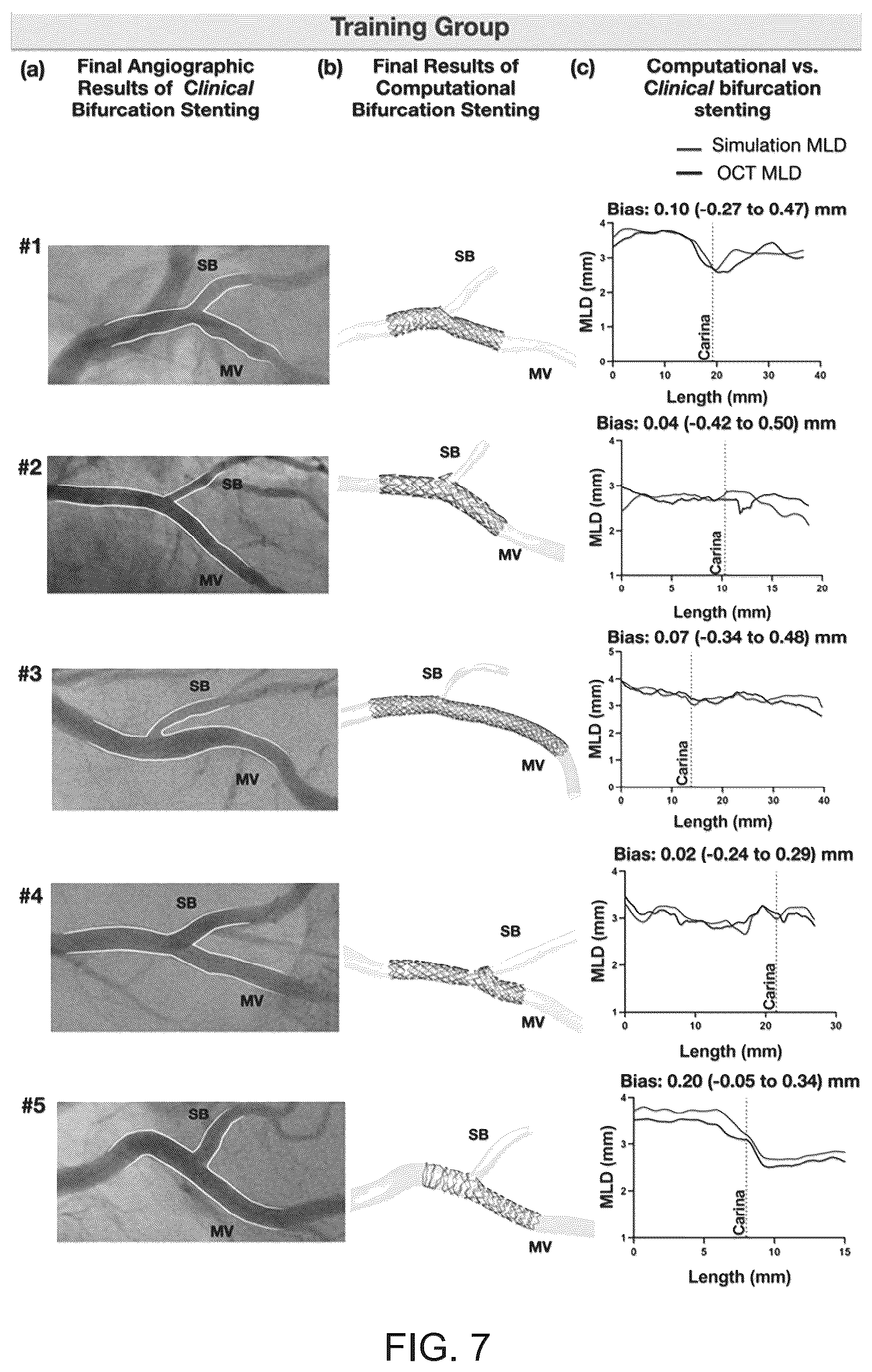 Patent US12096986 Figure 7 – Computational simulation platform for planning of interventional procedures