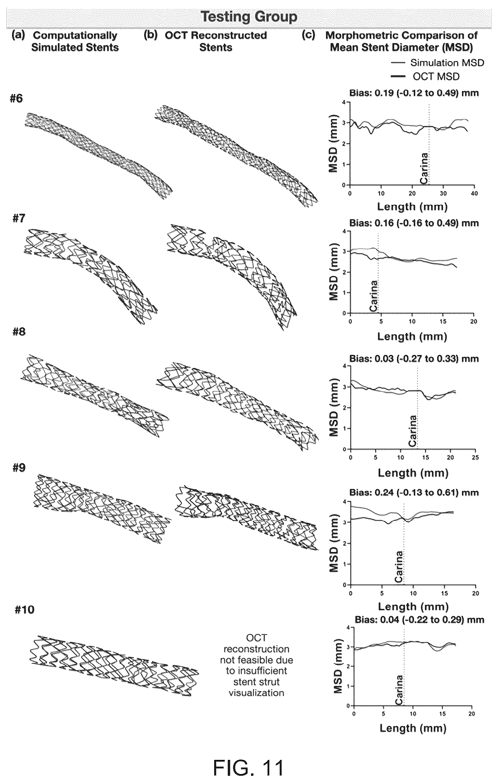 Patent US12096986 Figure 11 – Computational simulation platform for planning of interventional procedures