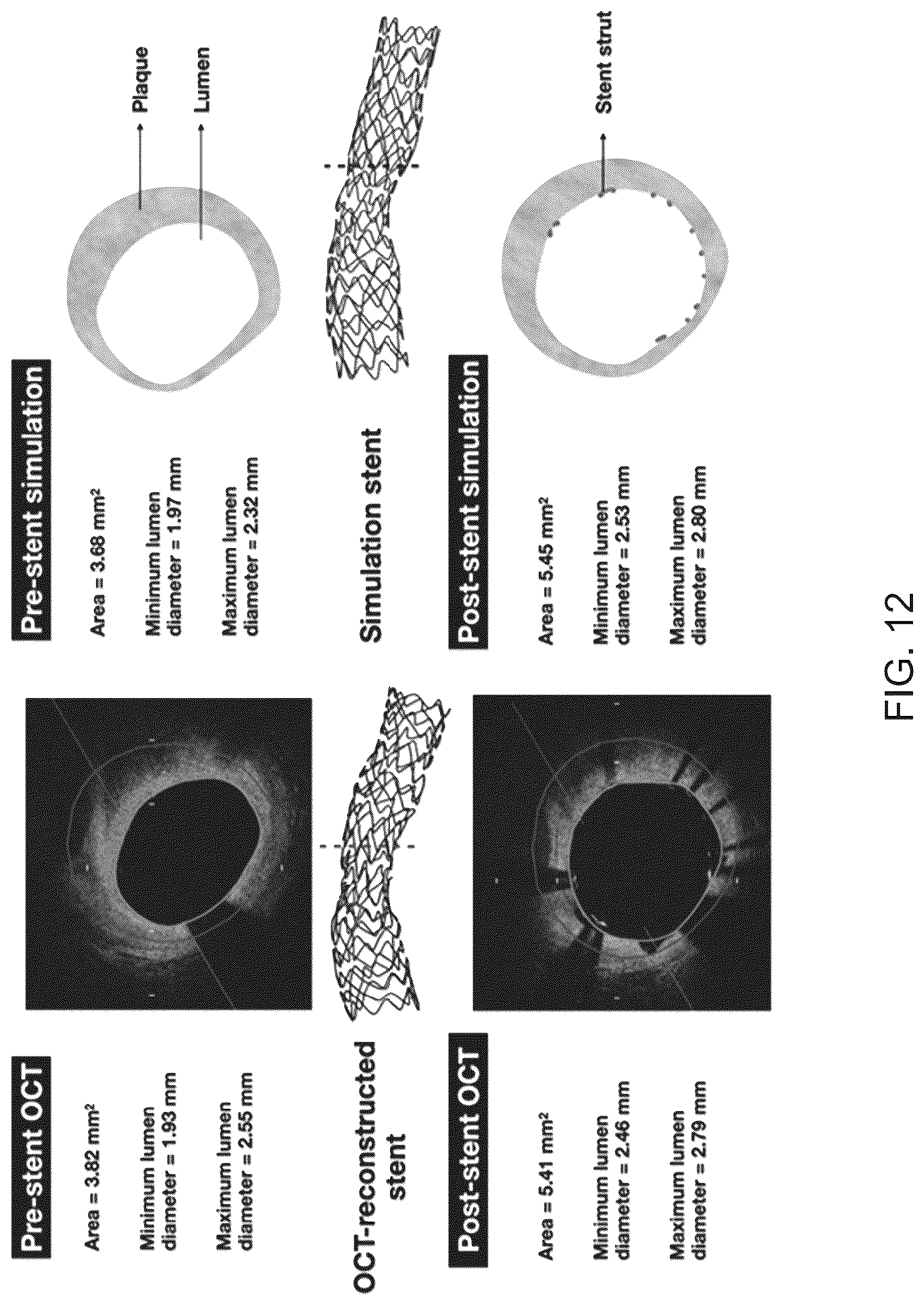 Patent US12096986 Figure 12 – Computational simulation platform for planning of interventional procedures