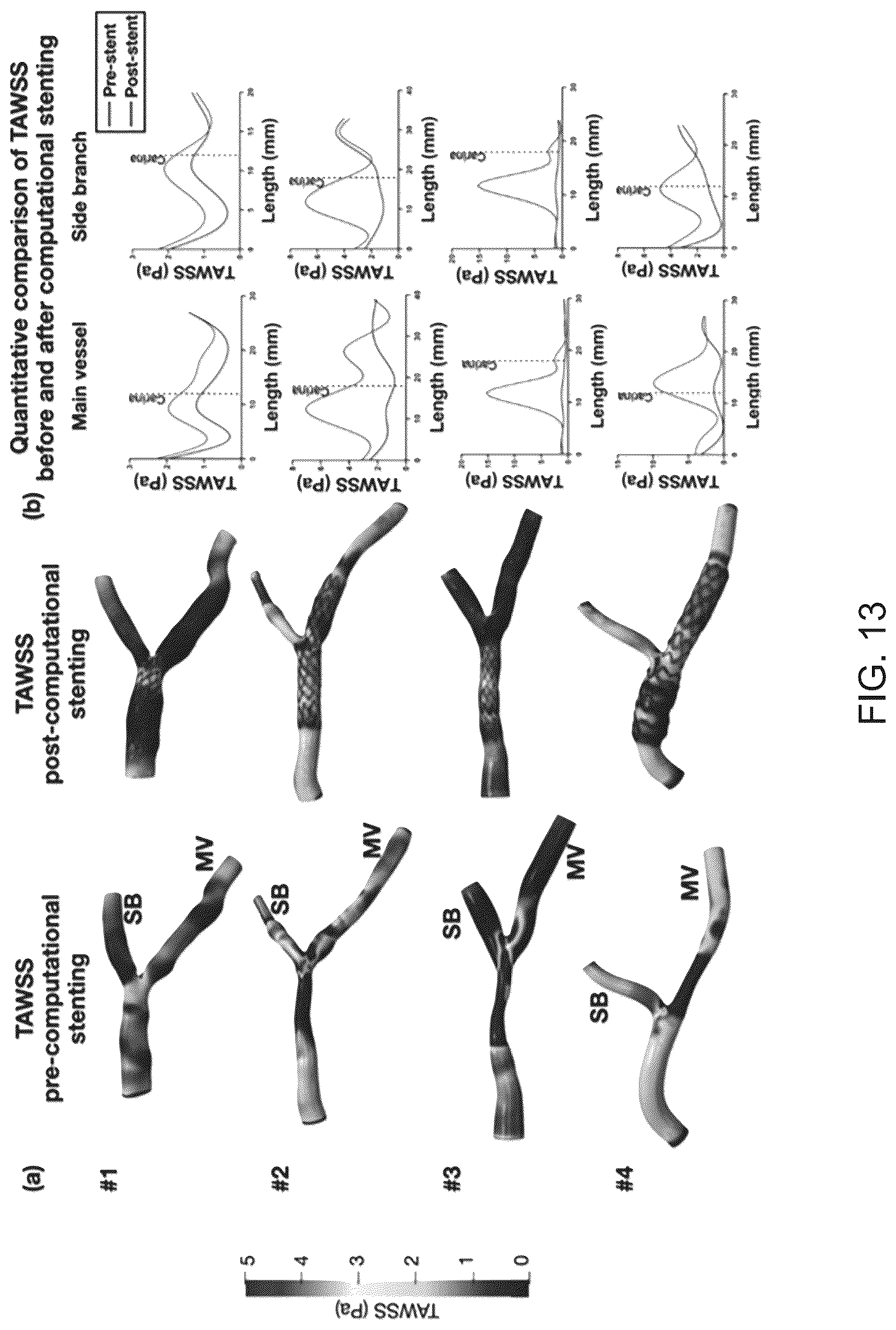 Patent US12096986 Figure 13 – Computational simulation platform for planning of interventional procedures