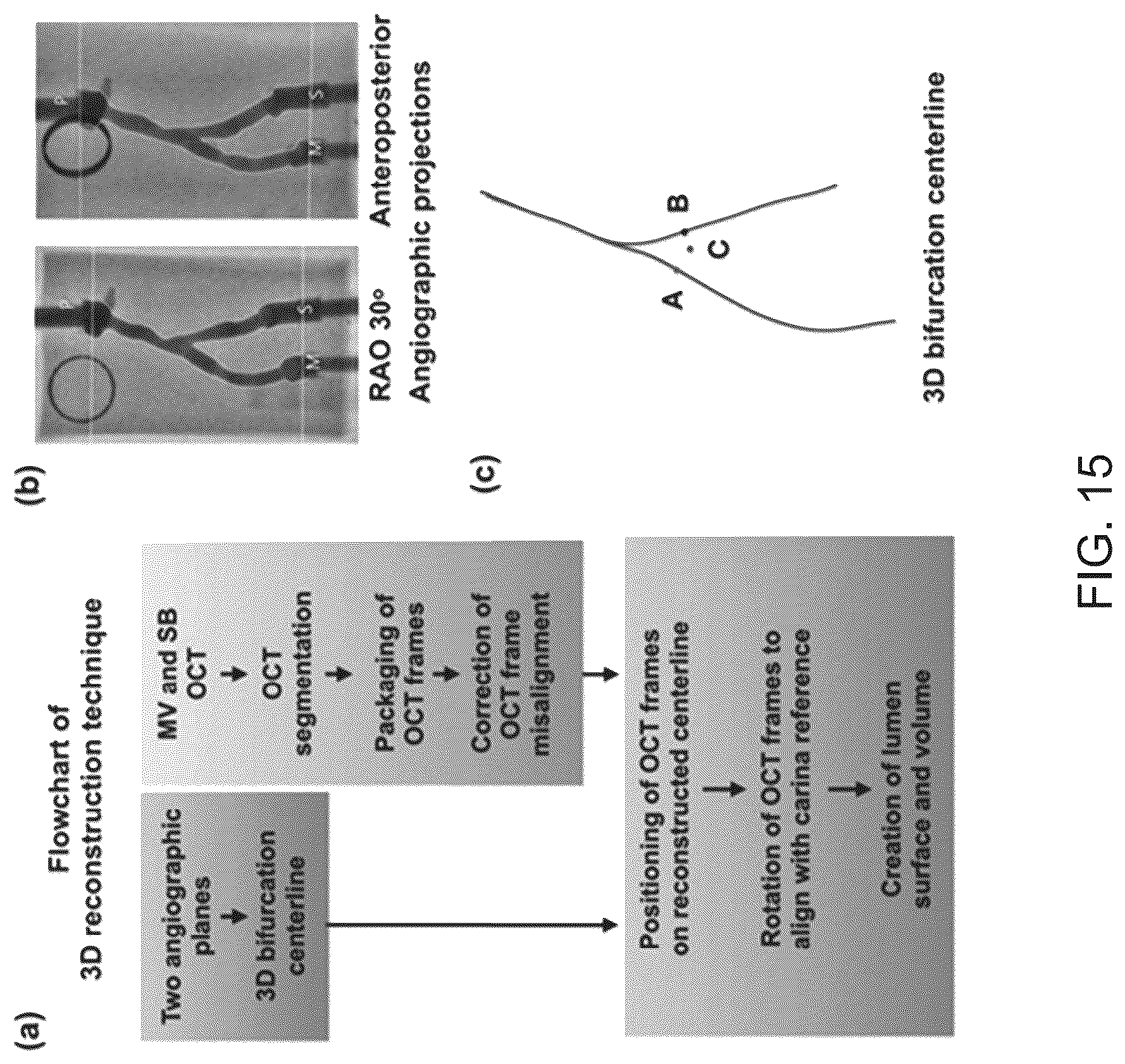 Patent US12096986 Figure 15 – Computational simulation platform for planning of interventional procedures