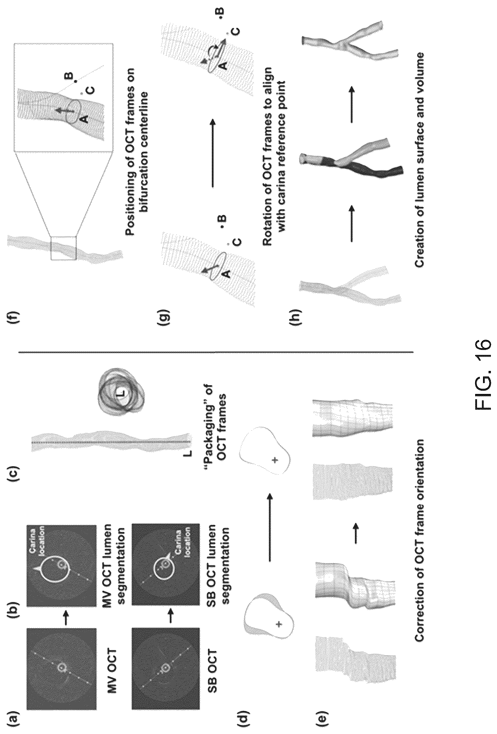 Patent US12096986 Figure 16 – Computational simulation platform for planning of interventional procedures