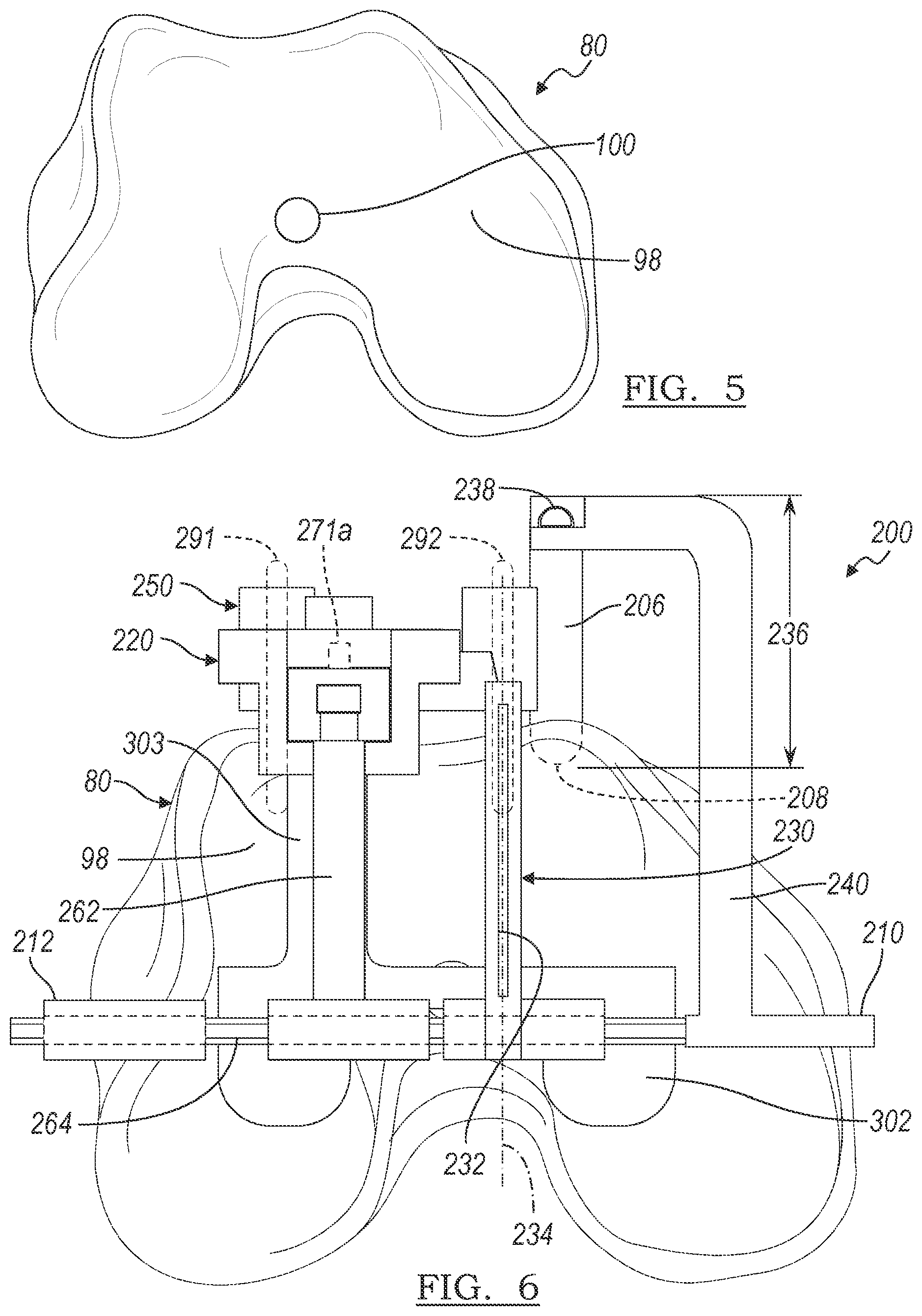 Patent US12096989 Figure 4 – Plan implementation