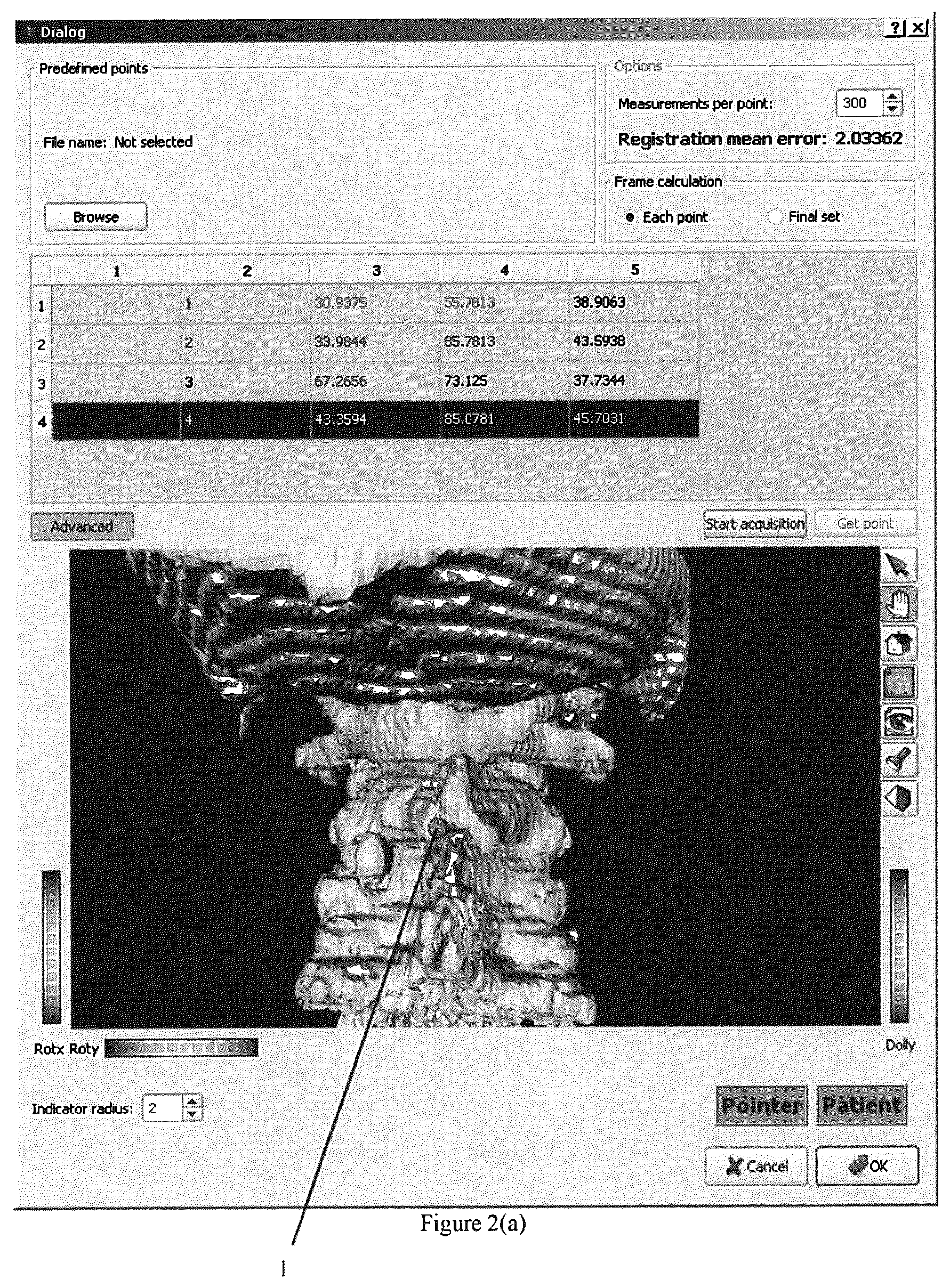 Patent US12096994 Figure 2 – Robotic system and method for spinal and other surgeries