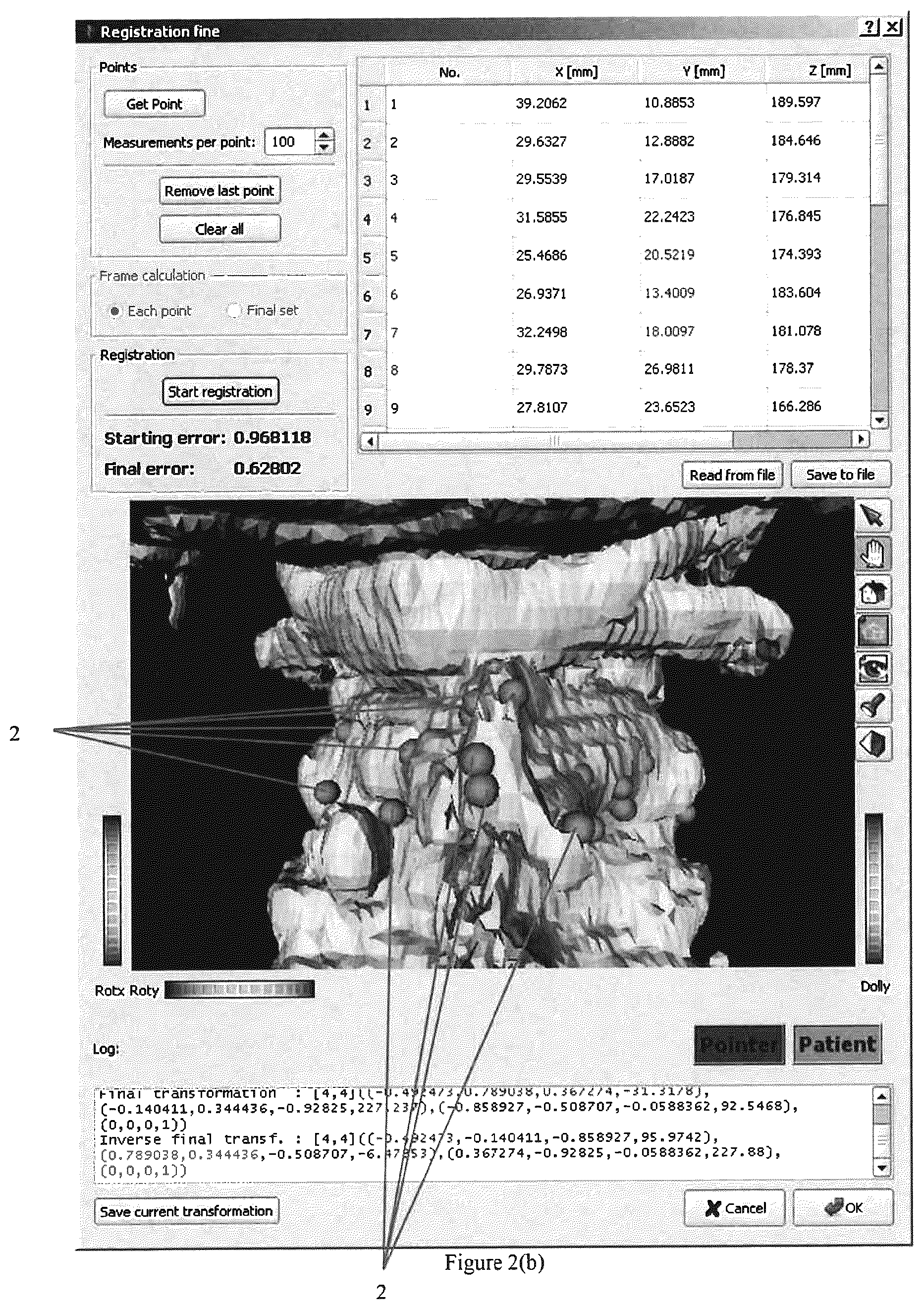 Patent US12096994 Figure 3 – Robotic system and method for spinal and other surgeries