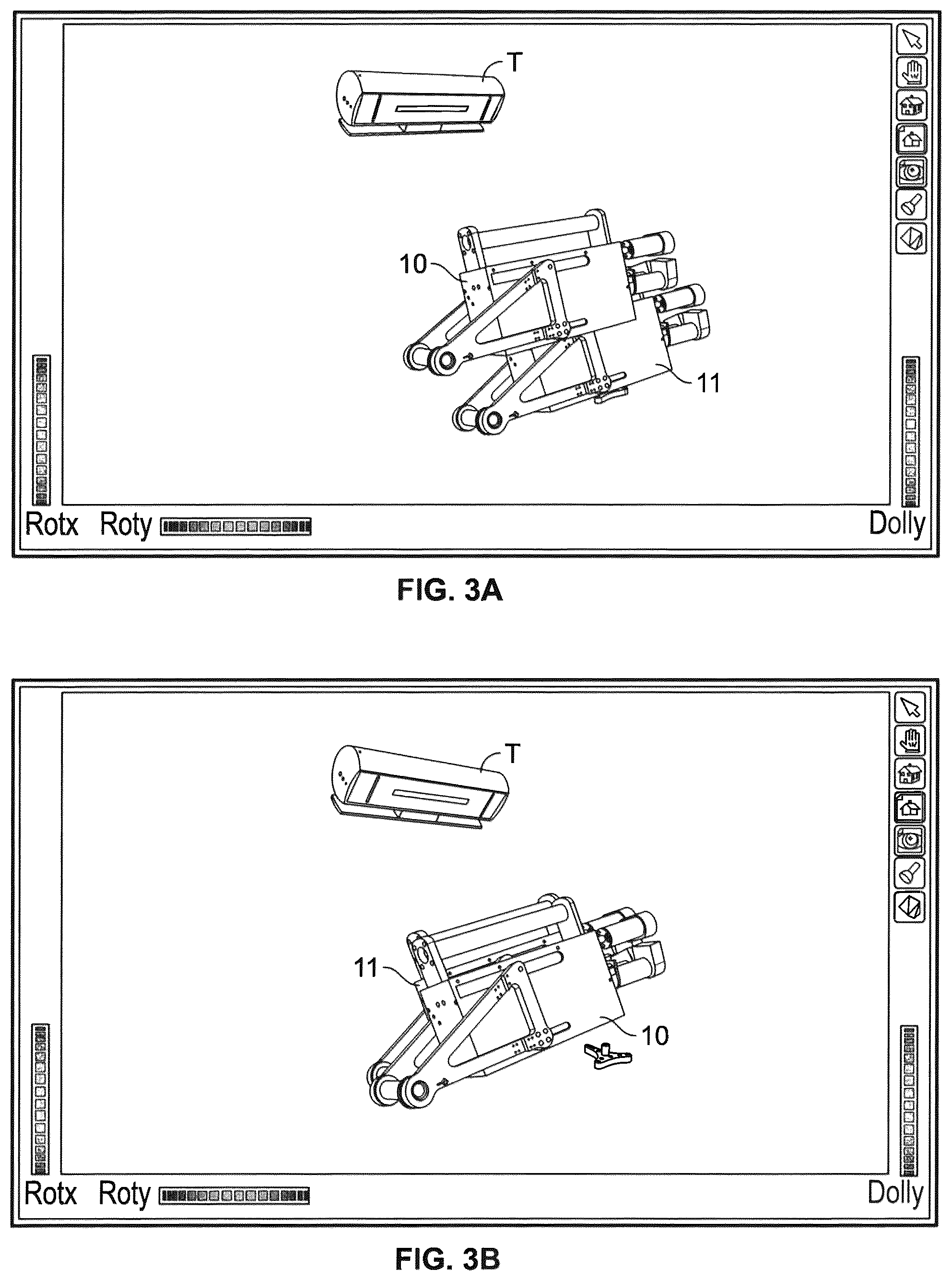 Patent US12096994 Figure 4 – Robotic system and method for spinal and other surgeries