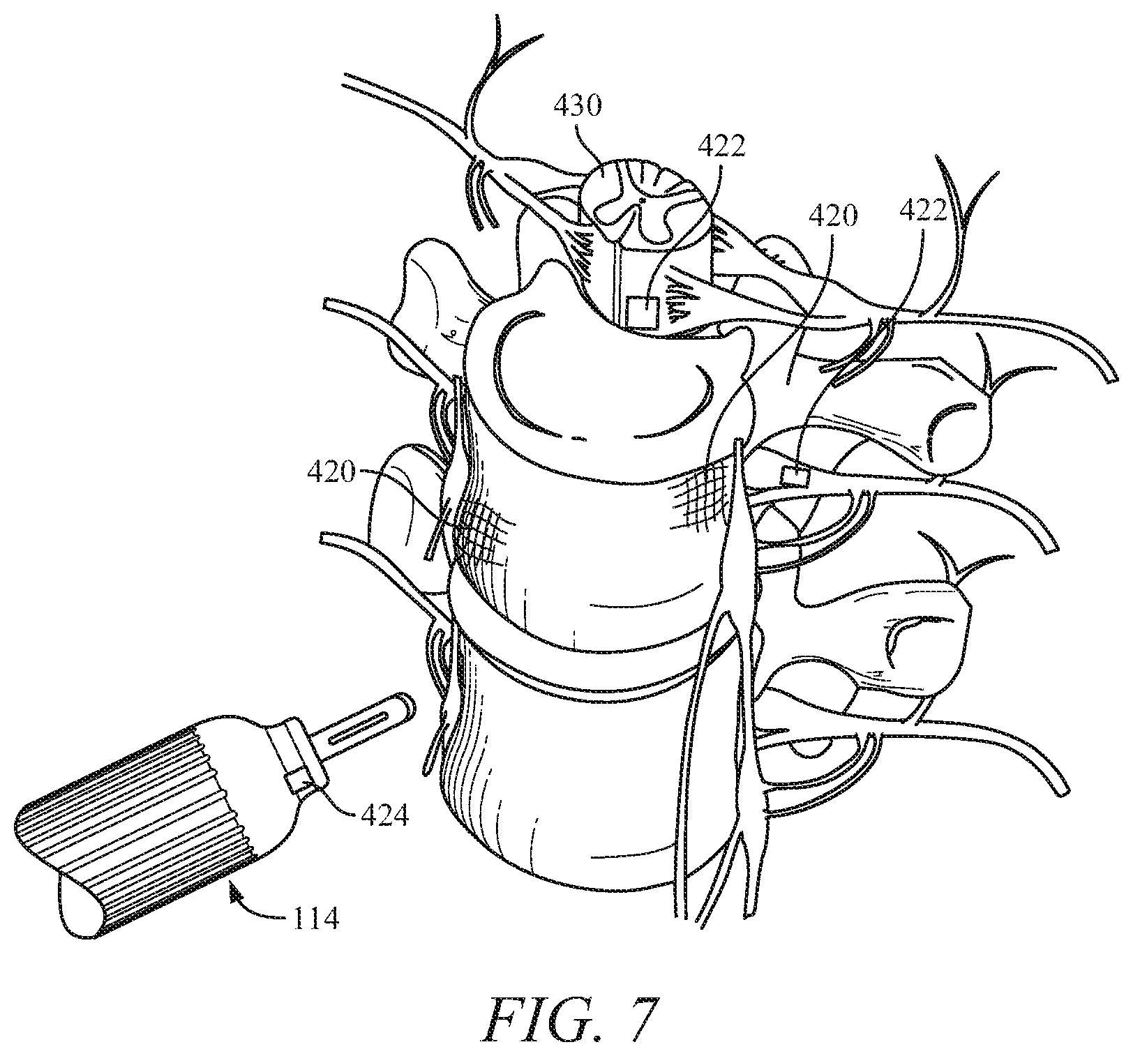 Patent US12096995 Figure 8 – Systems and methods for navigation and visualization