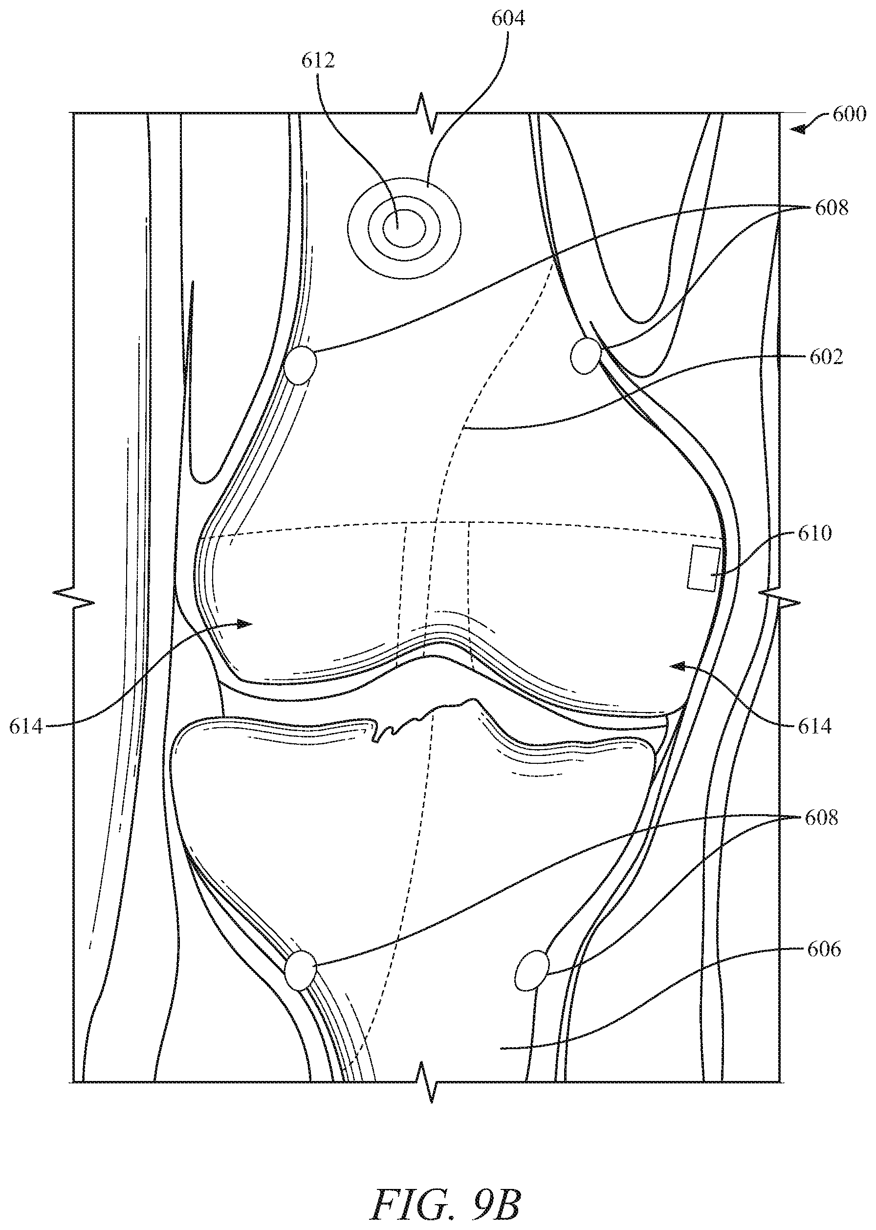 Patent US12096995 Figure 11 – Systems and methods for navigation and visualization