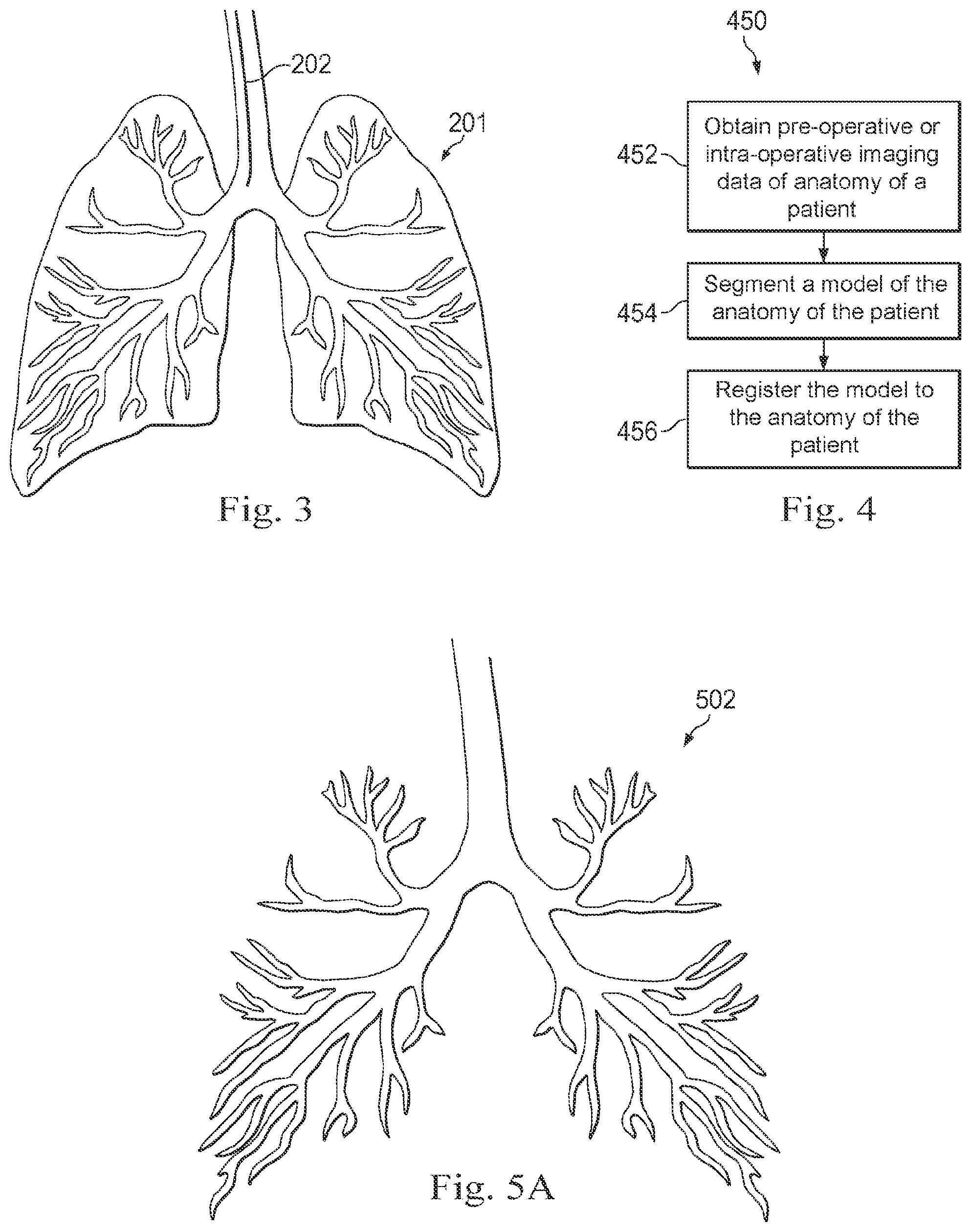 Patent US12096996 Figure 3 – Systems and methods of registration for image-guided procedures