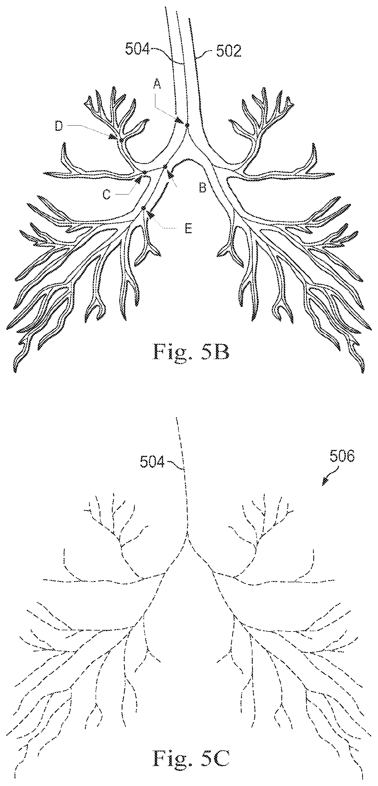 Patent US12096996 Figure 4 – Systems and methods of registration for image-guided procedures