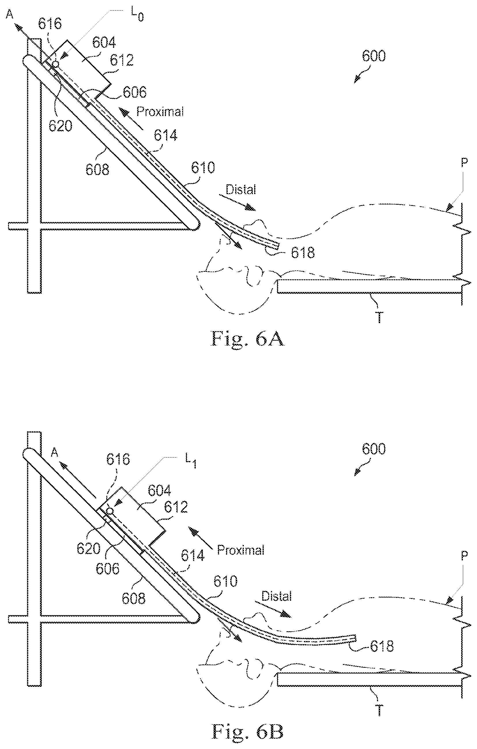 Patent US12096996 Figure 5 – Systems and methods of registration for image-guided procedures