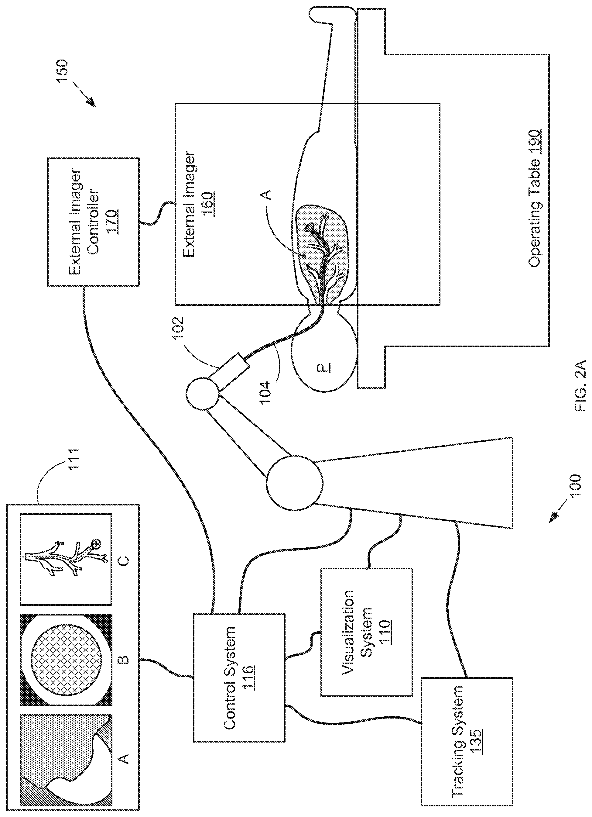 Patent US12097000 Figure 3 – Systems and methods for robotic medical system integration with external imaging