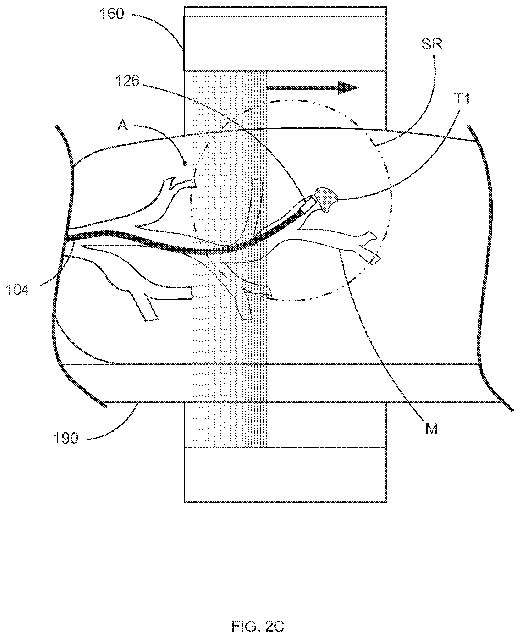 Patent US12097000 Figure 5 – Systems and methods for robotic medical system integration with external imaging