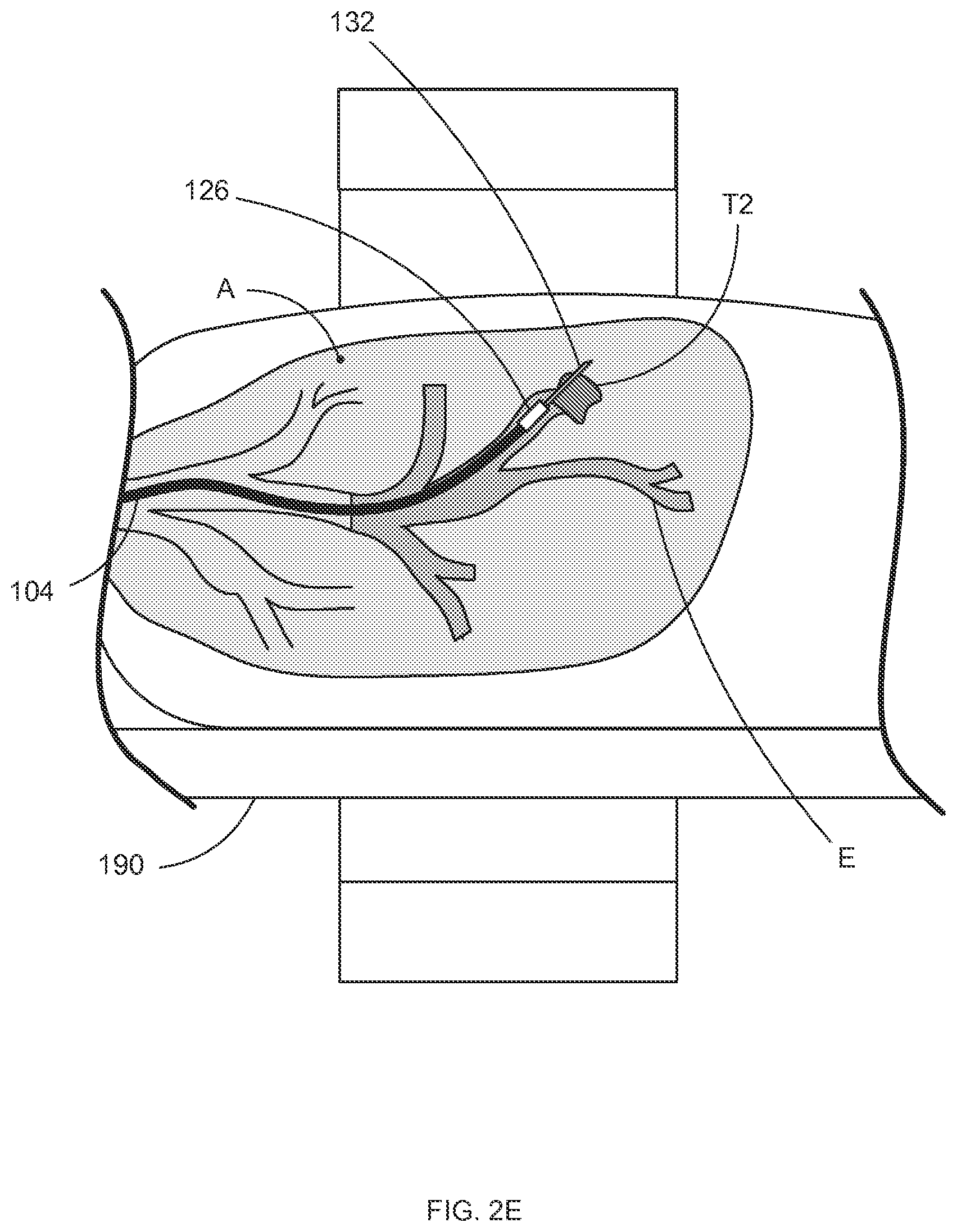 Patent US12097000 Figure 7 – Systems and methods for robotic medical system integration with external imaging