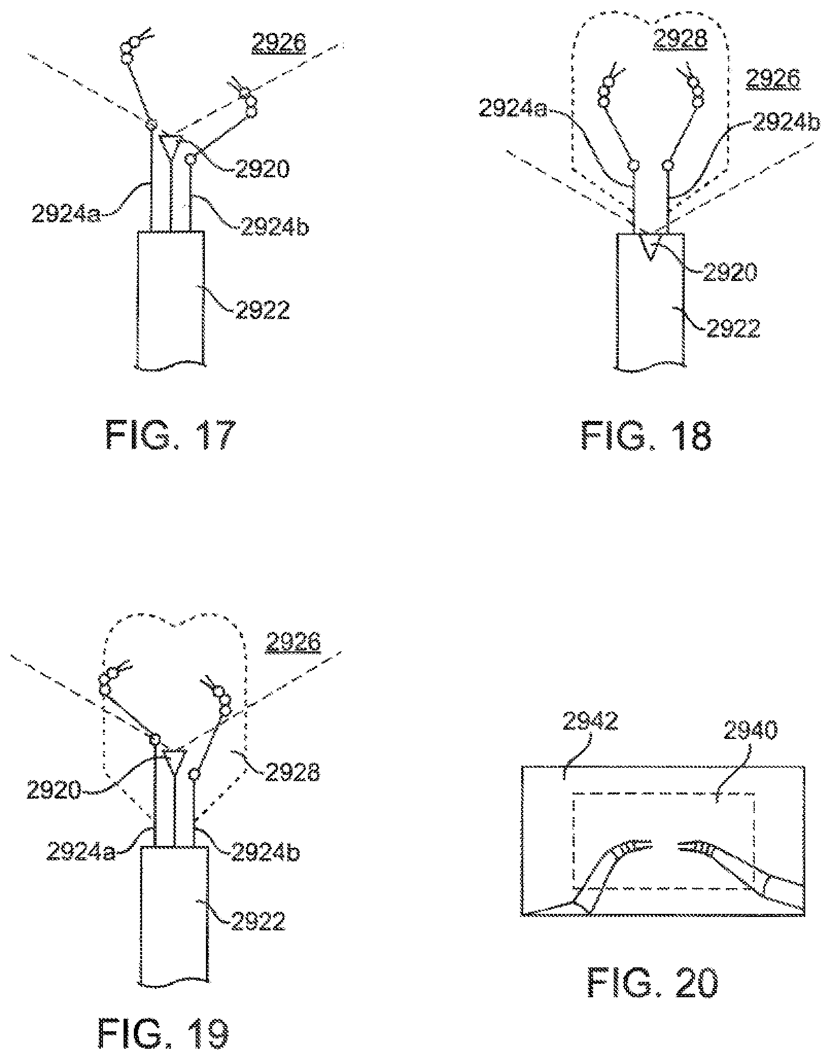 Patent US12097002 Figure 10 – Medical robotic system with coupled control modes