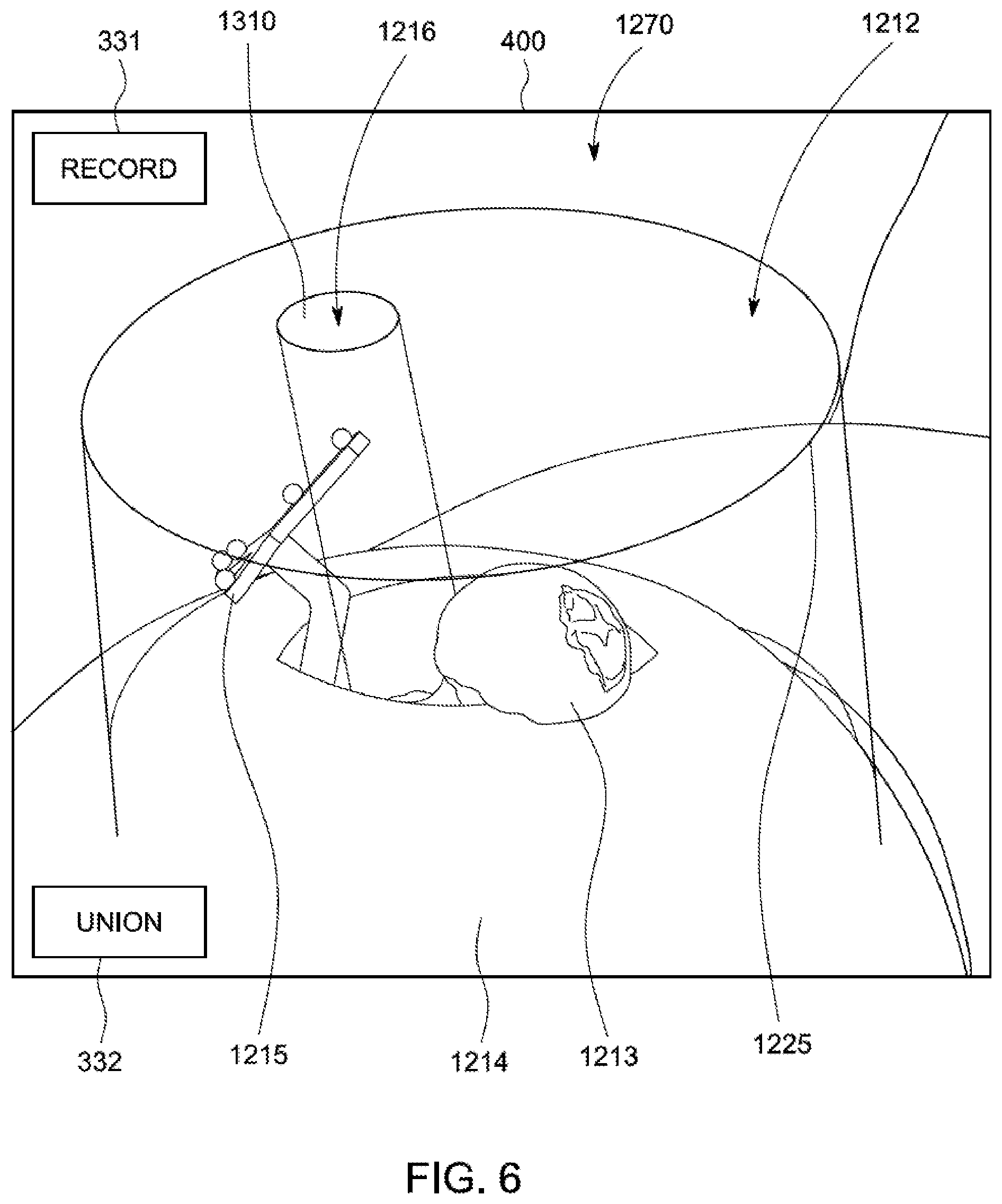 Patent US12097003 Figure 6 – System and method for interaction and definition of tool pathways for a robotic cutting tool