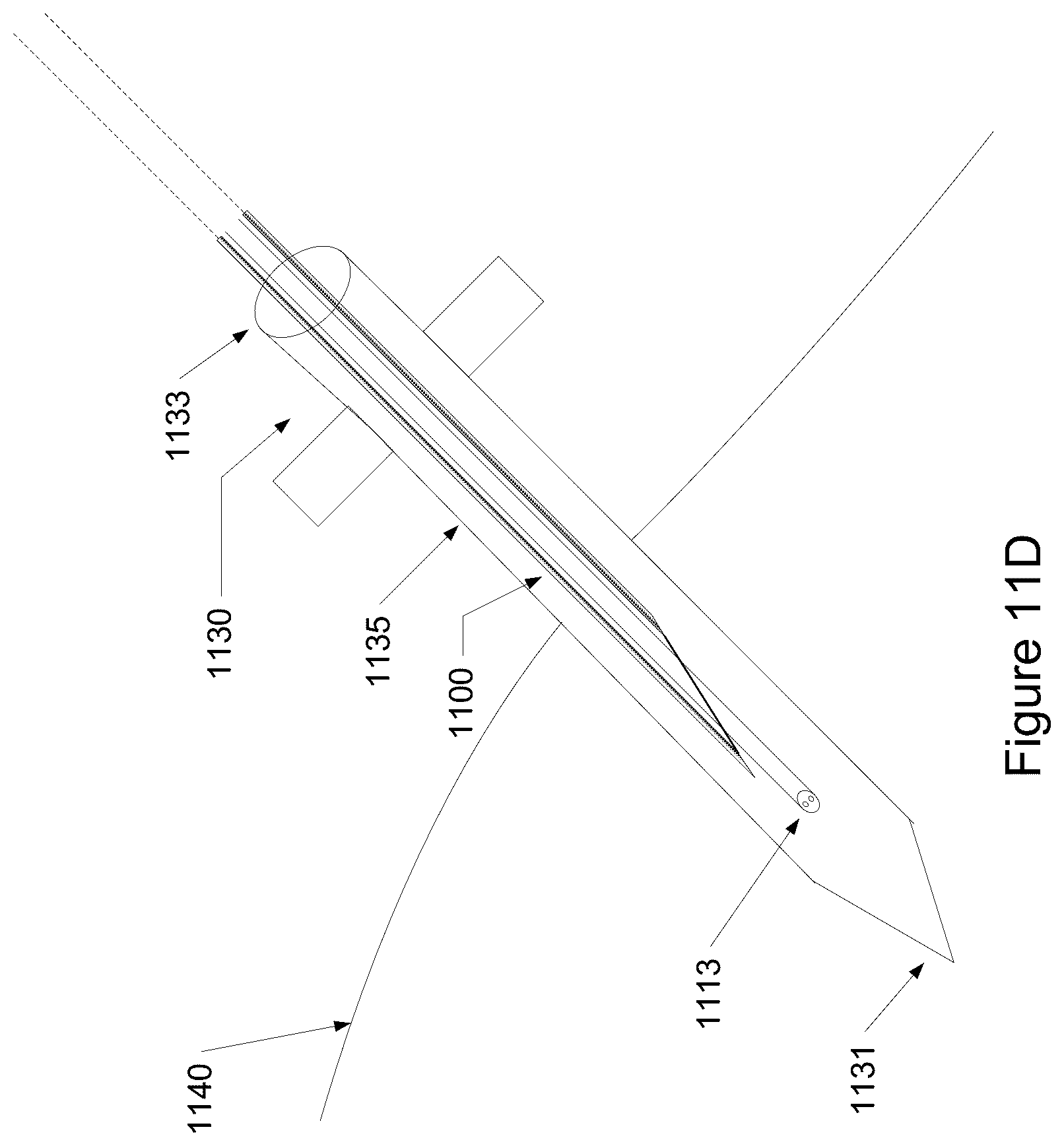 Patent US12097008 Figure 11 – Using an oximeter probe to detect intestinal ischemia