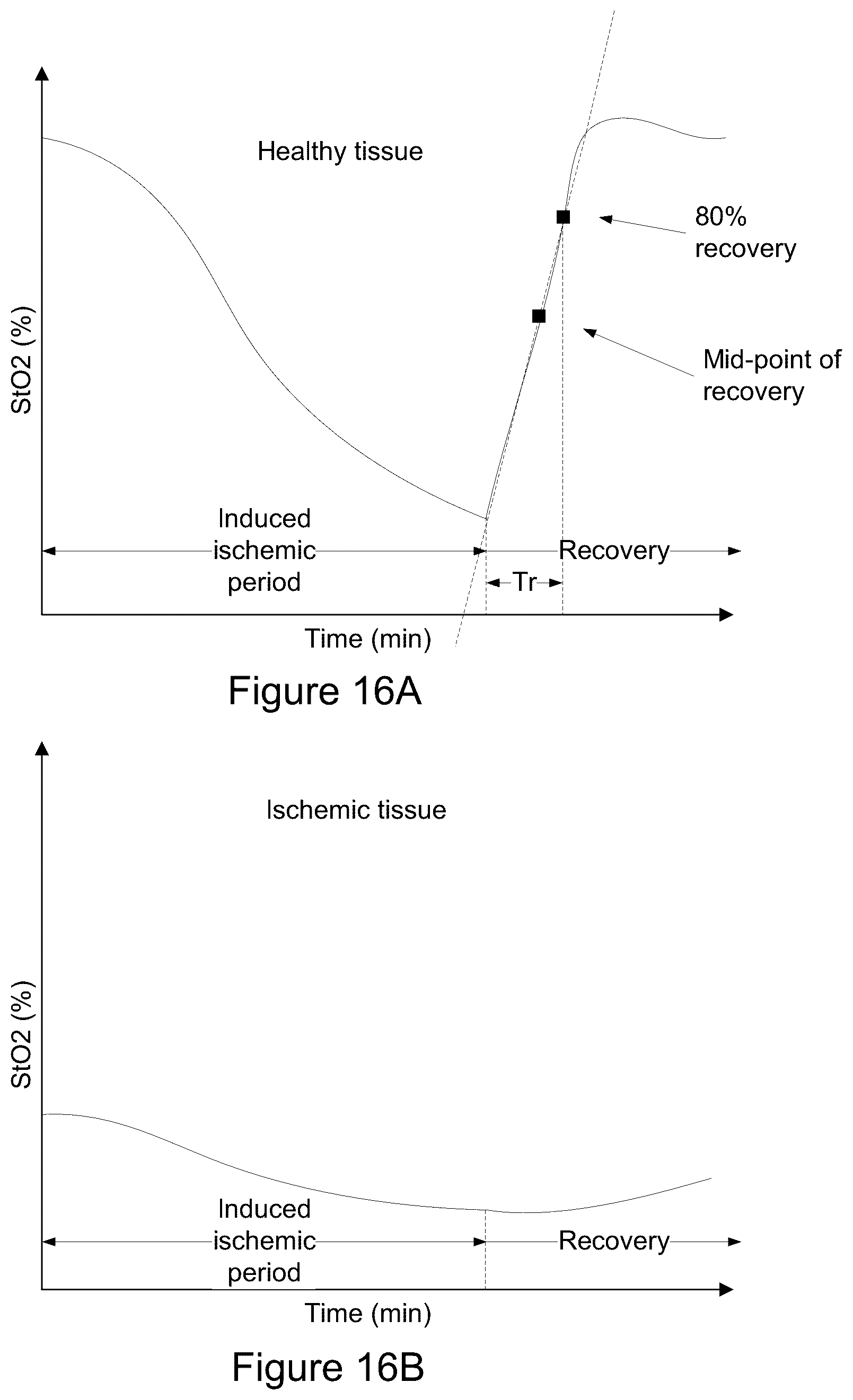Patent US12097008 Figure 16 – Using an oximeter probe to detect intestinal ischemia