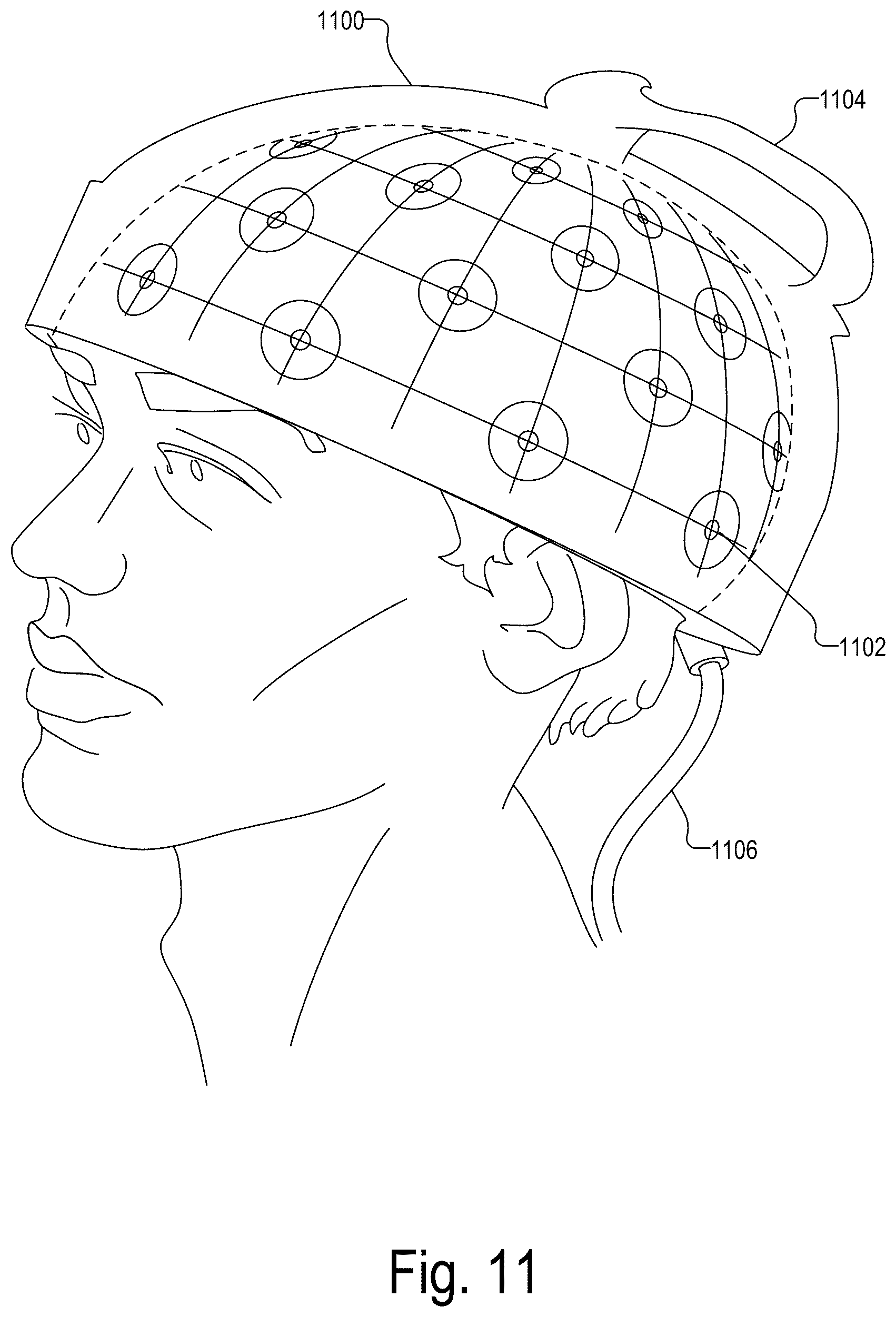 Patent US12097010 Figure 11 – Maintaining consistent photodetector sensitivity in an optical measurement system