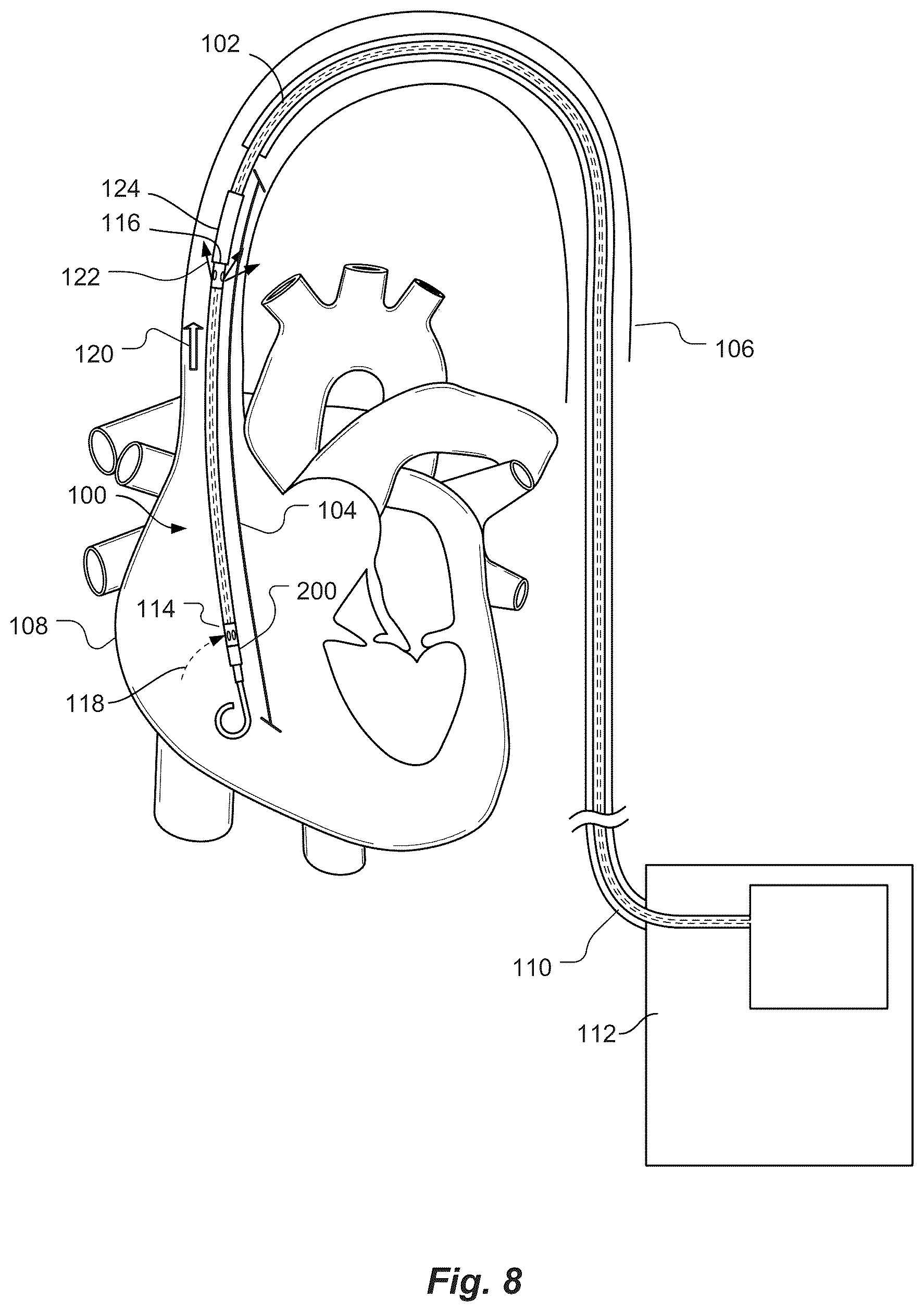 Patent US12097016 Figure 6 – Blood flow rate measurement system