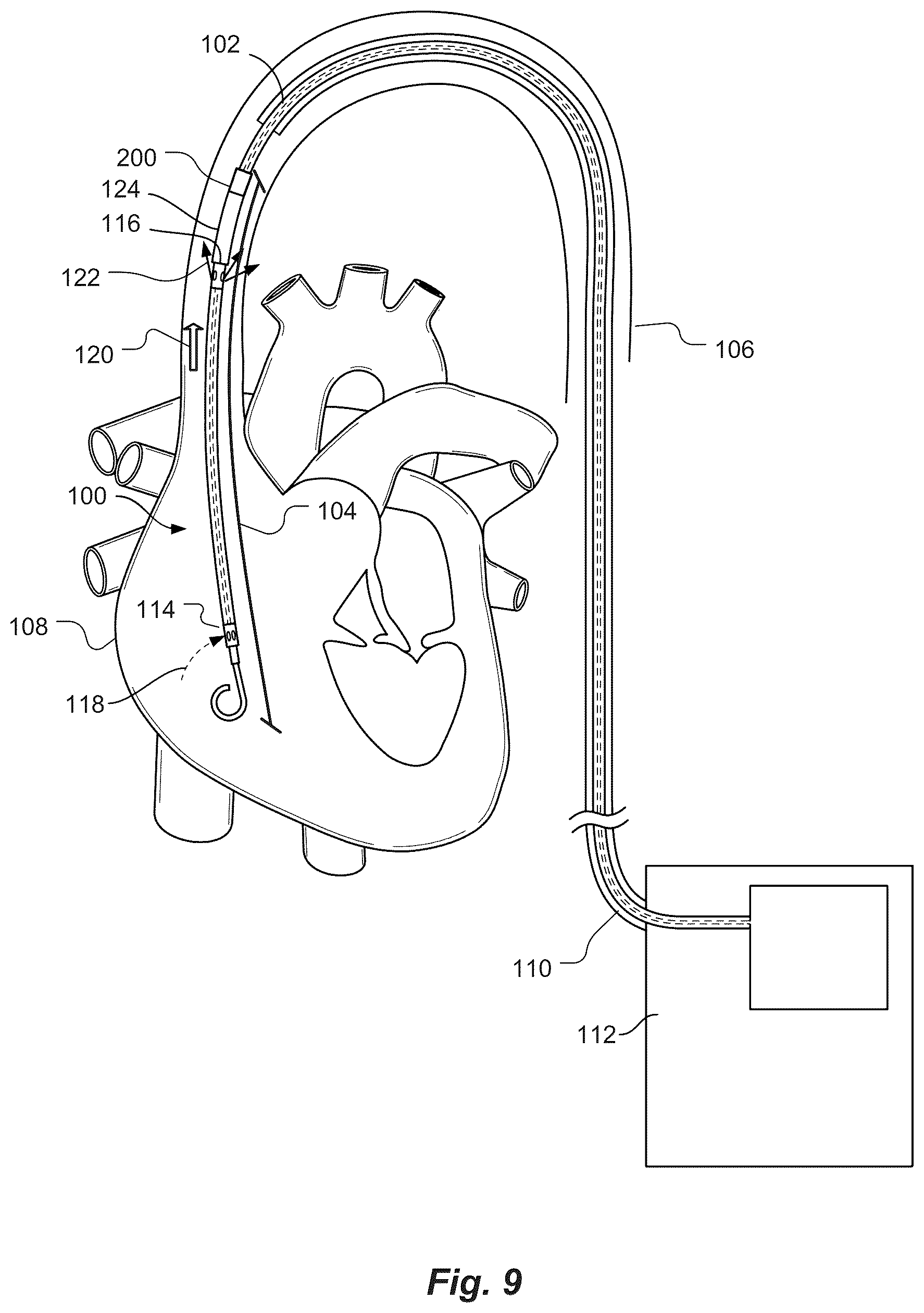Patent US12097016 Figure 7 – Blood flow rate measurement system