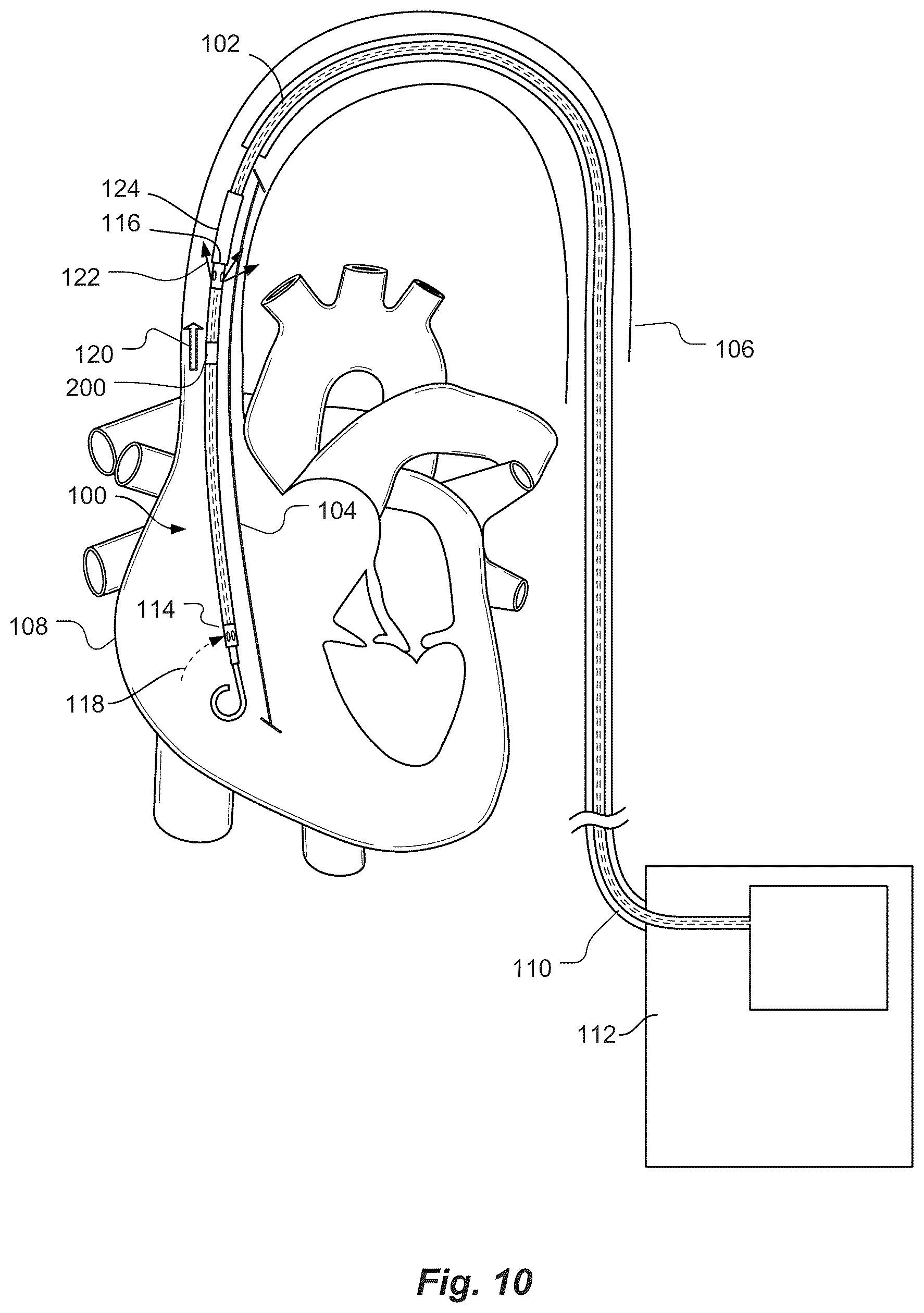 Patent US12097016 Figure 8 – Blood flow rate measurement system