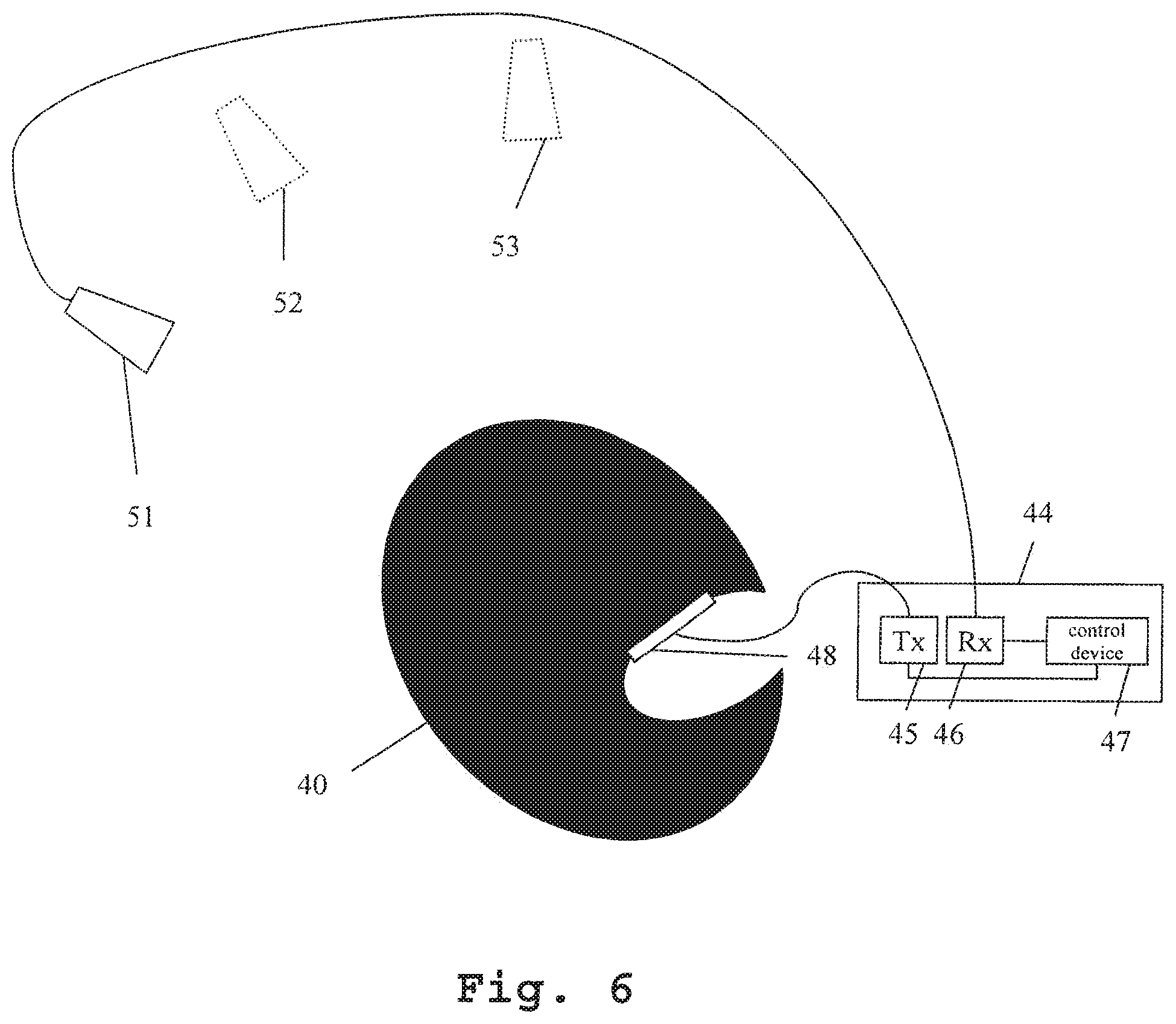 Patent US12097018 Figure 3 – Measuring device and a method for microwave-based investigation