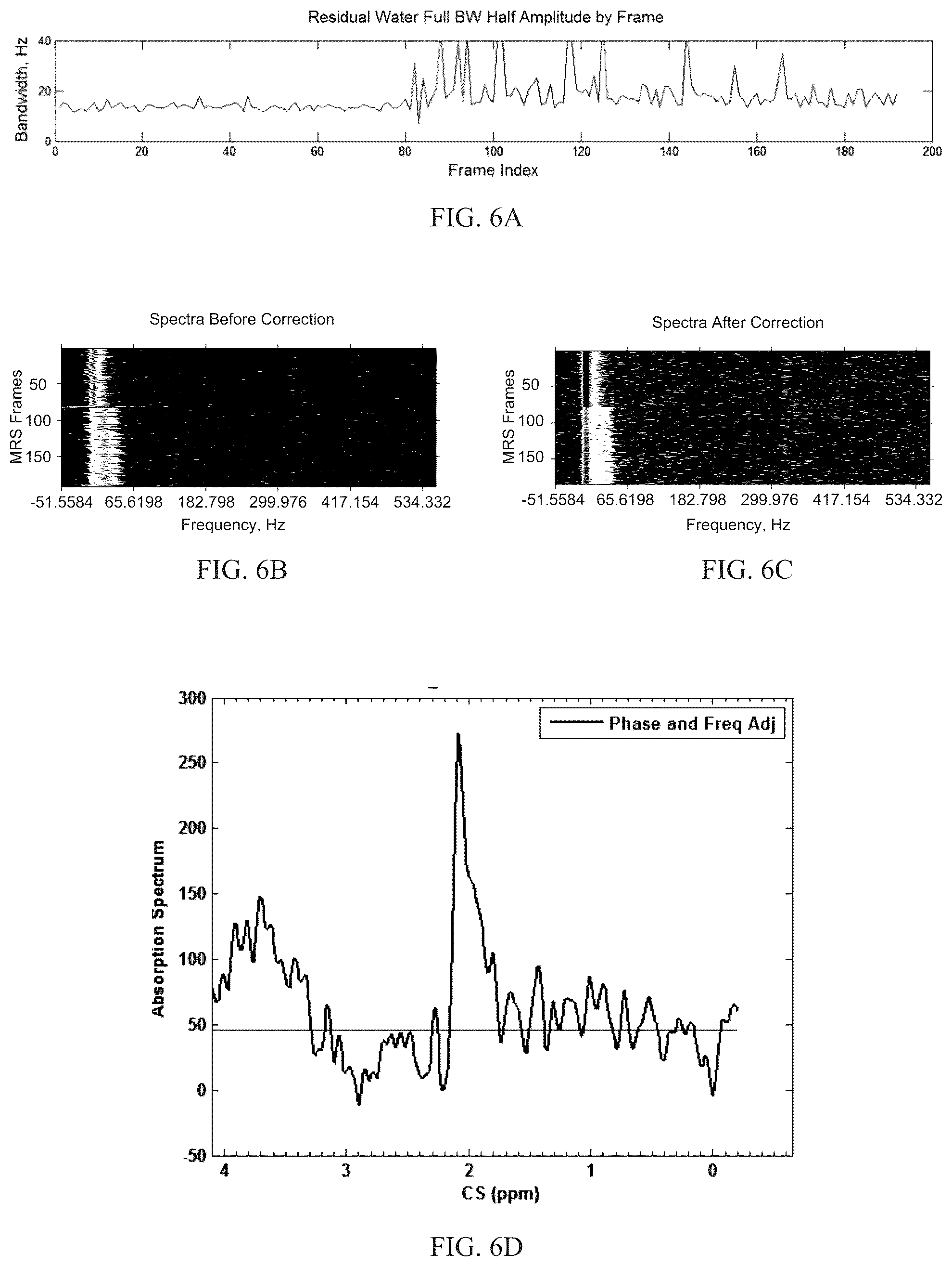 Patent US12097020 Figure 4 – Magnetic resonance spectroscopy pulse sequence, acquisition, and processing system and method