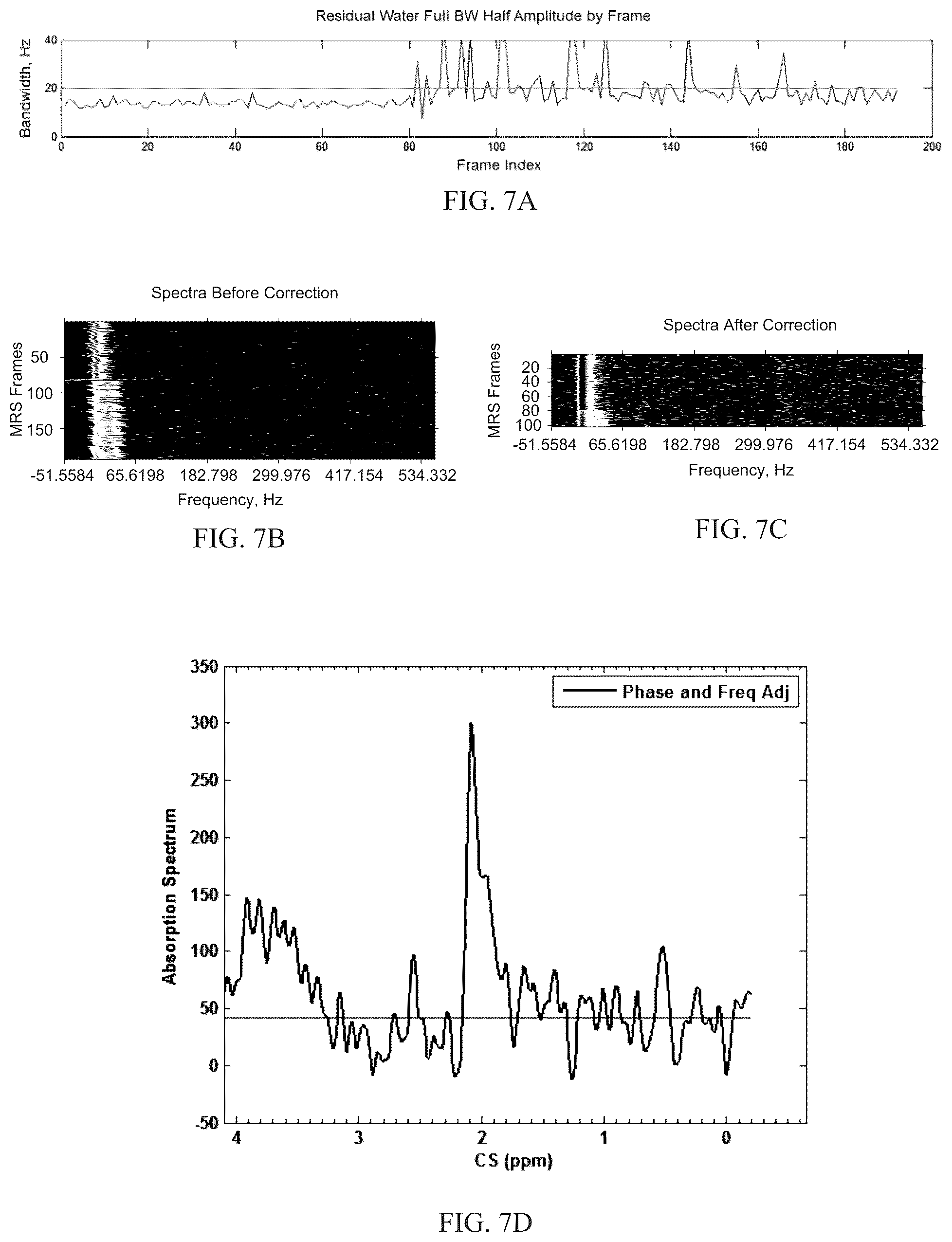 Patent US12097020 Figure 5 – Magnetic resonance spectroscopy pulse sequence, acquisition, and processing system and method