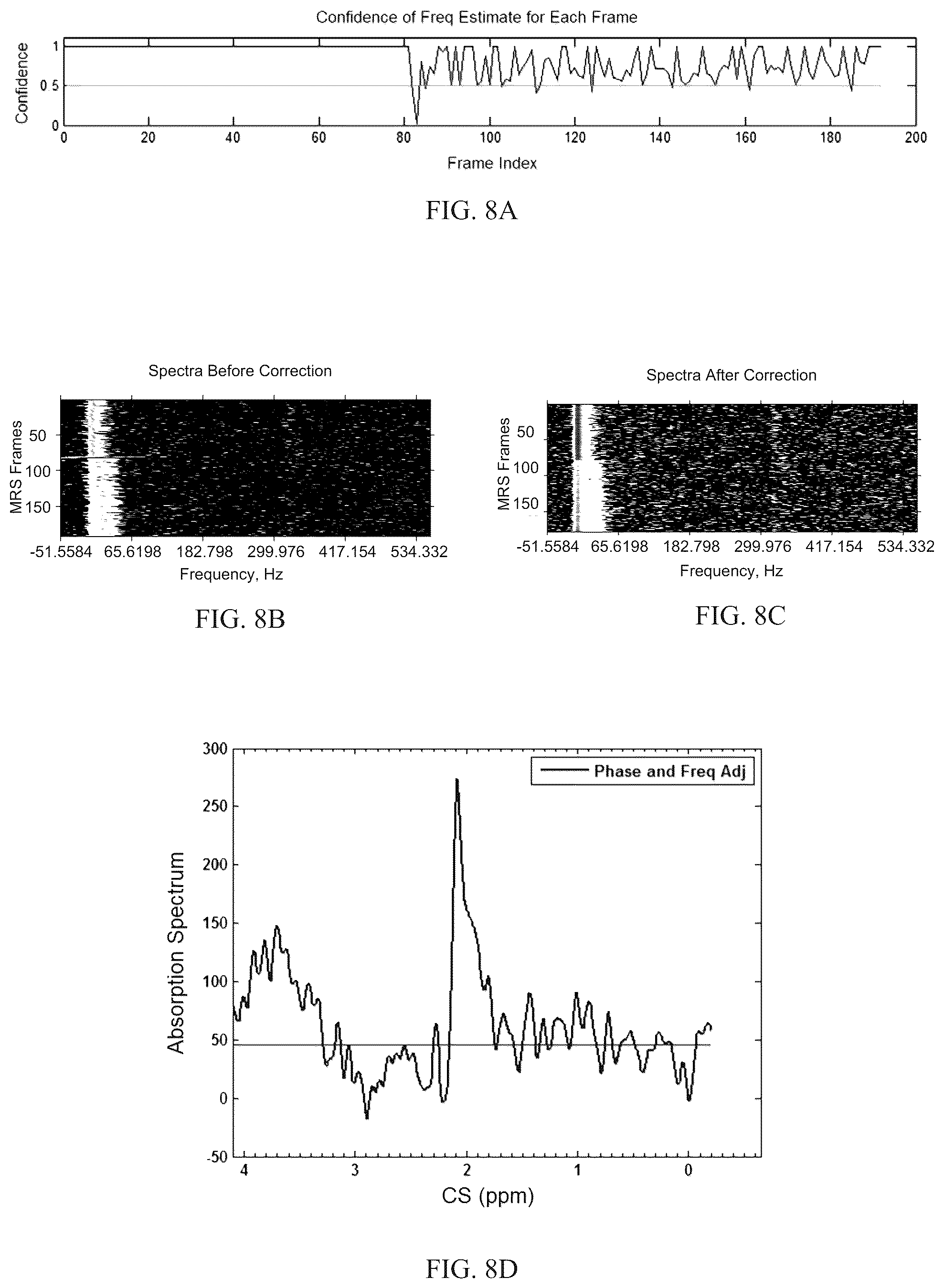 Patent US12097020 Figure 6 – Magnetic resonance spectroscopy pulse sequence, acquisition, and processing system and method