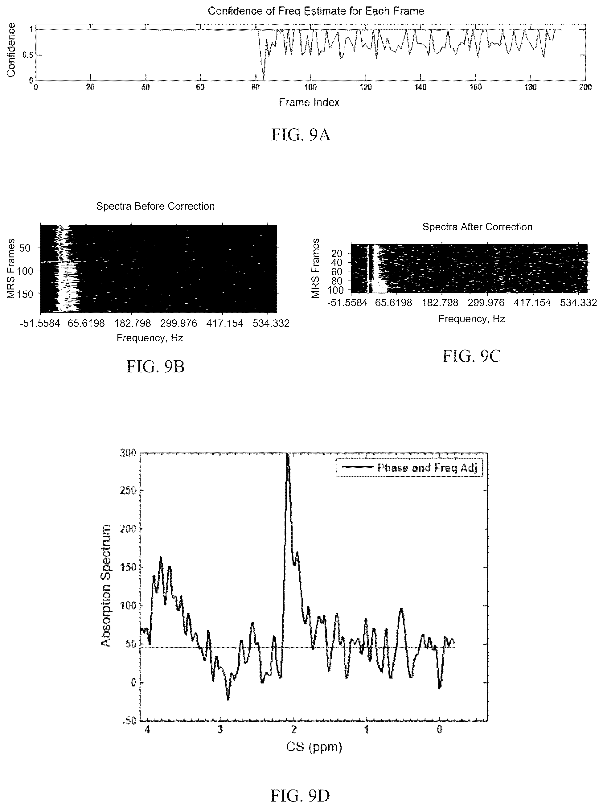Patent US12097020 Figure 7 – Magnetic resonance spectroscopy pulse sequence, acquisition, and processing system and method