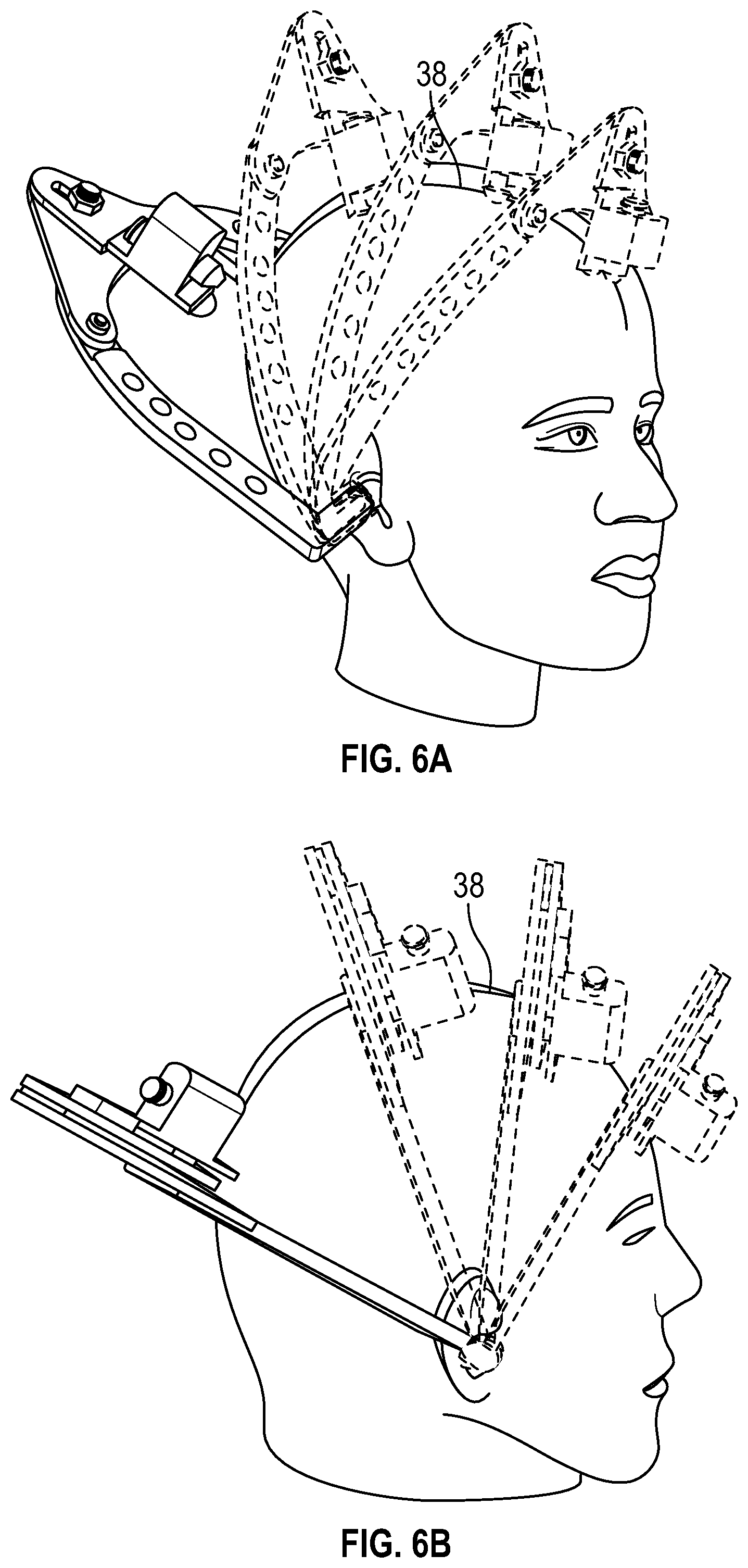 Patent US12097022 Figure 5 – Cranial midline marking device and method of using