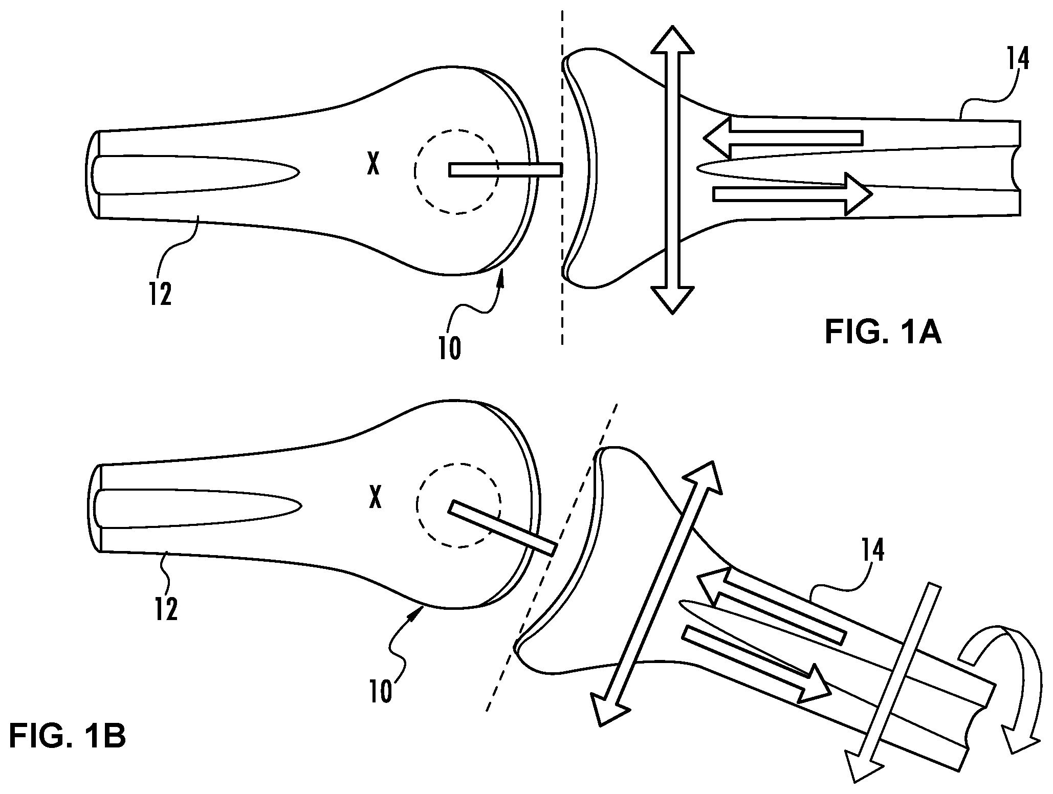 Patent US12097023 — Device for sensing displacement during a joint mobilization procedure and method for using such a device to quantify joint mobilization and detect joint laxity — Figure 1