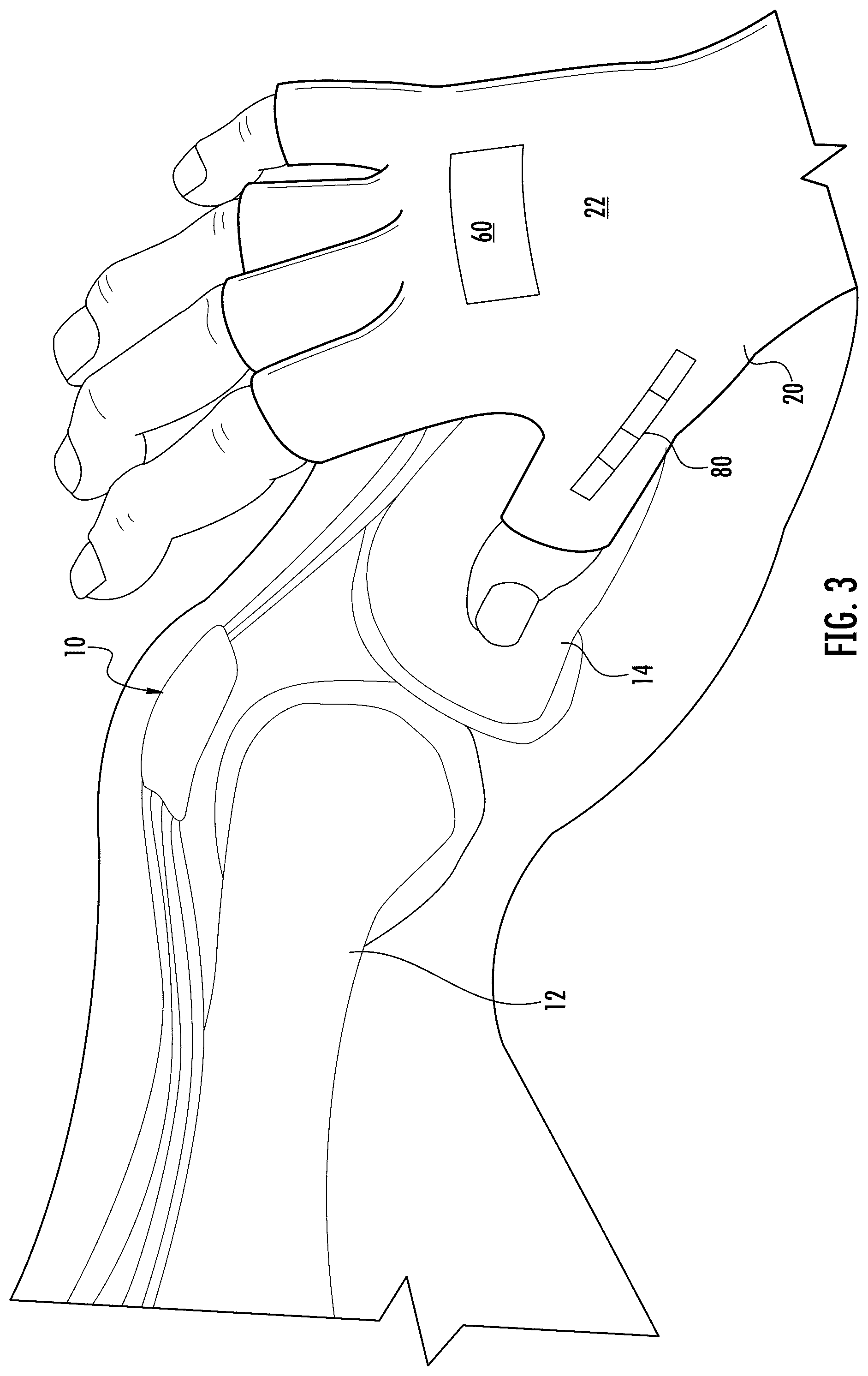 Patent US12097023 Figure 3 – Device for sensing displacement during a joint mobilization procedure and method for using such a device to quantify joint mobilization and detect joint laxity