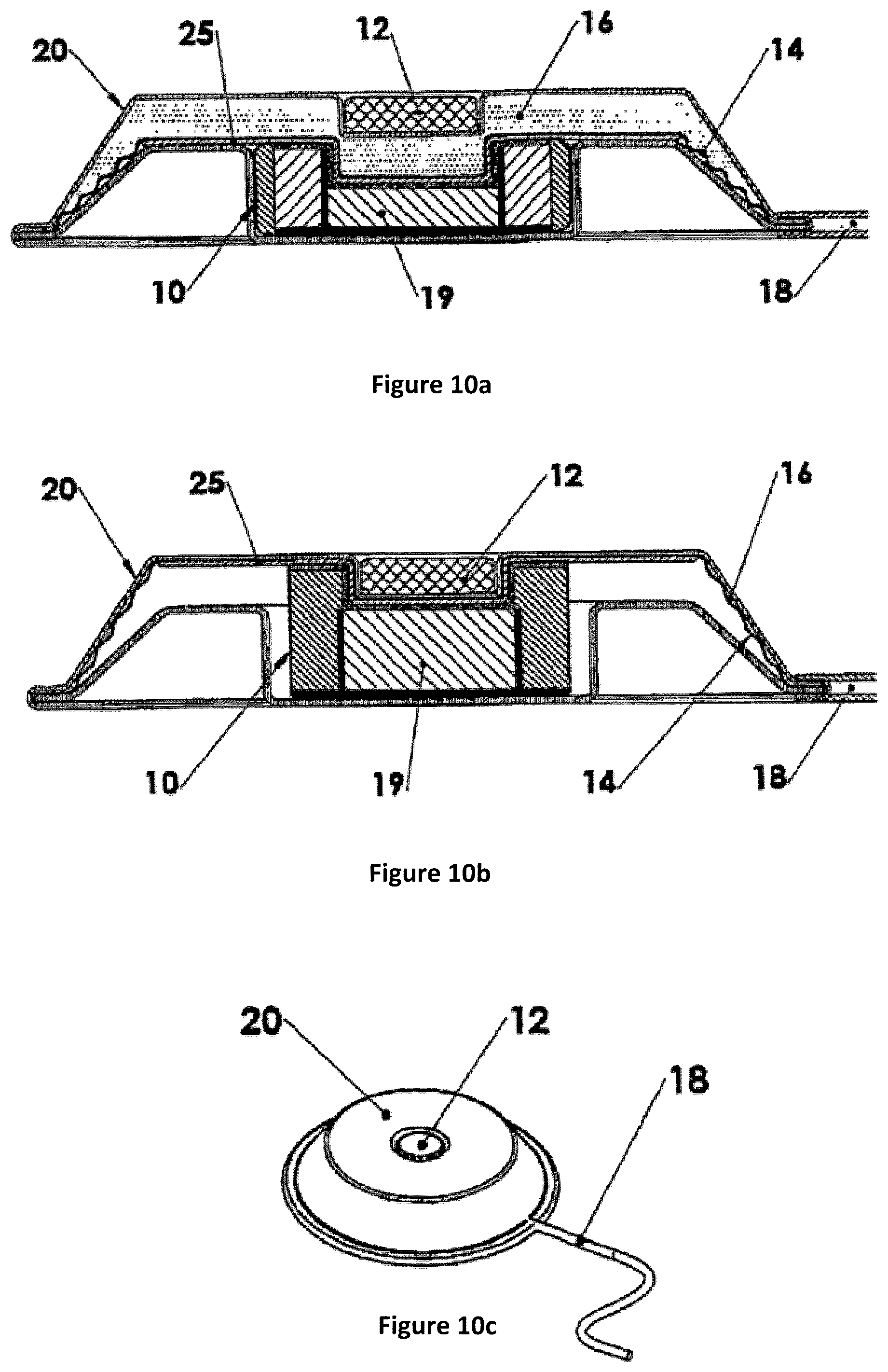 Patent US12097028 Figure 11 – Drug delivery device with electrically controlled volume changing means