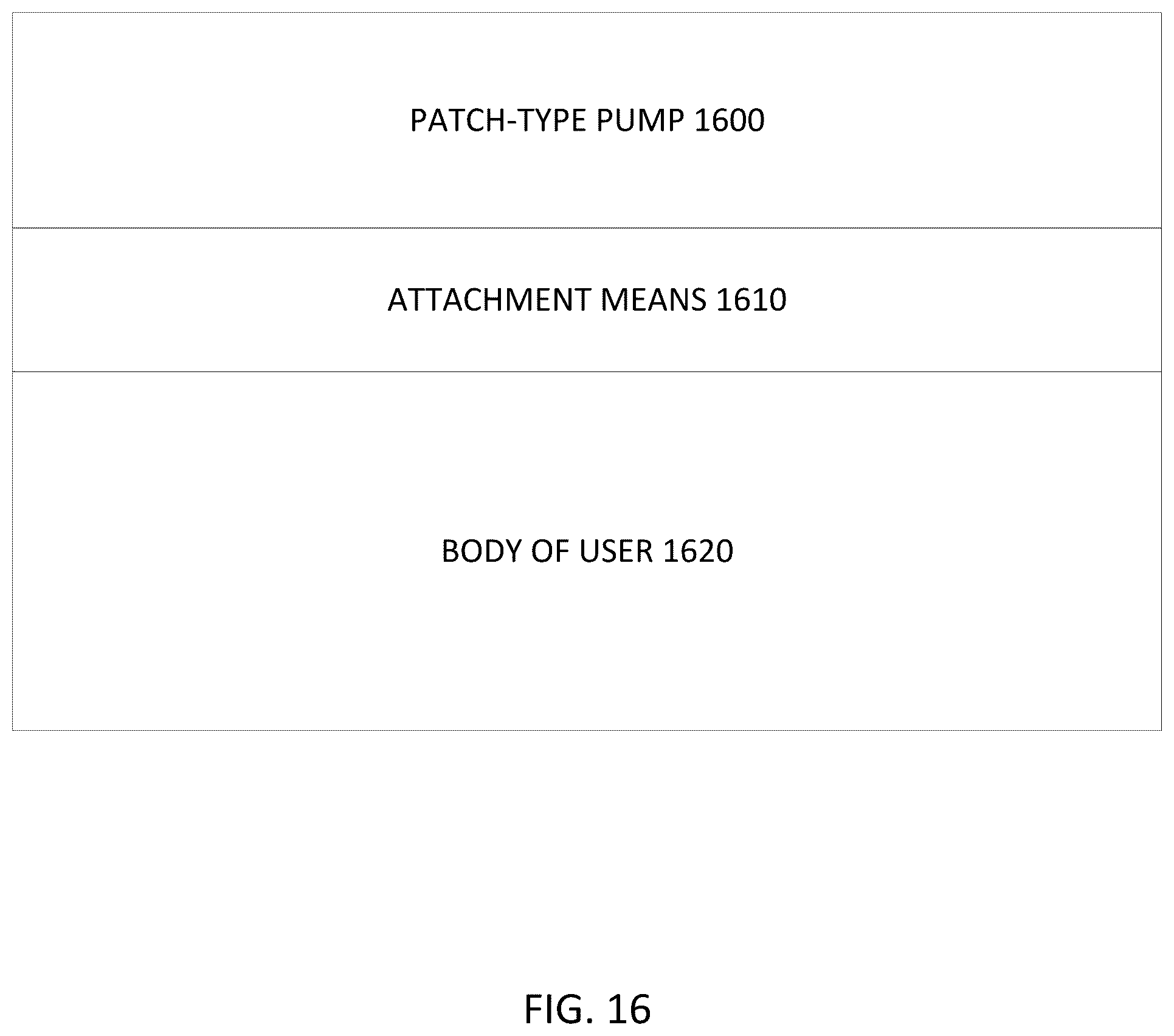 Patent US12097028 Figure 20 – Drug delivery device with electrically controlled volume changing means