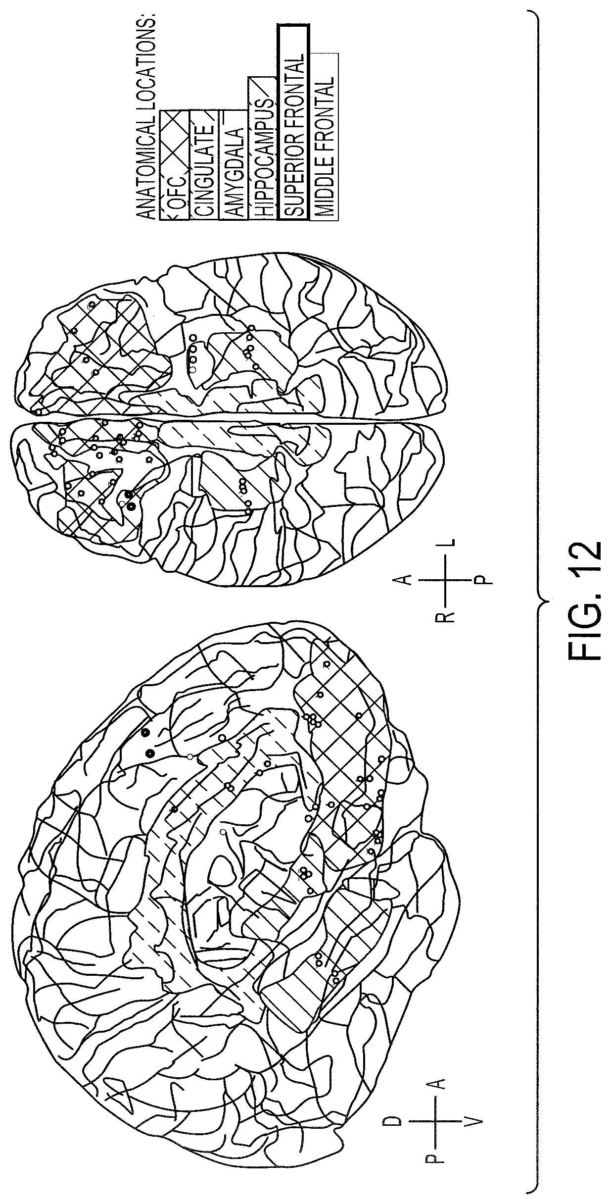Patent US12097029 Figure 12 – Decoding neuropsychiatric states from multi-site brain network activity