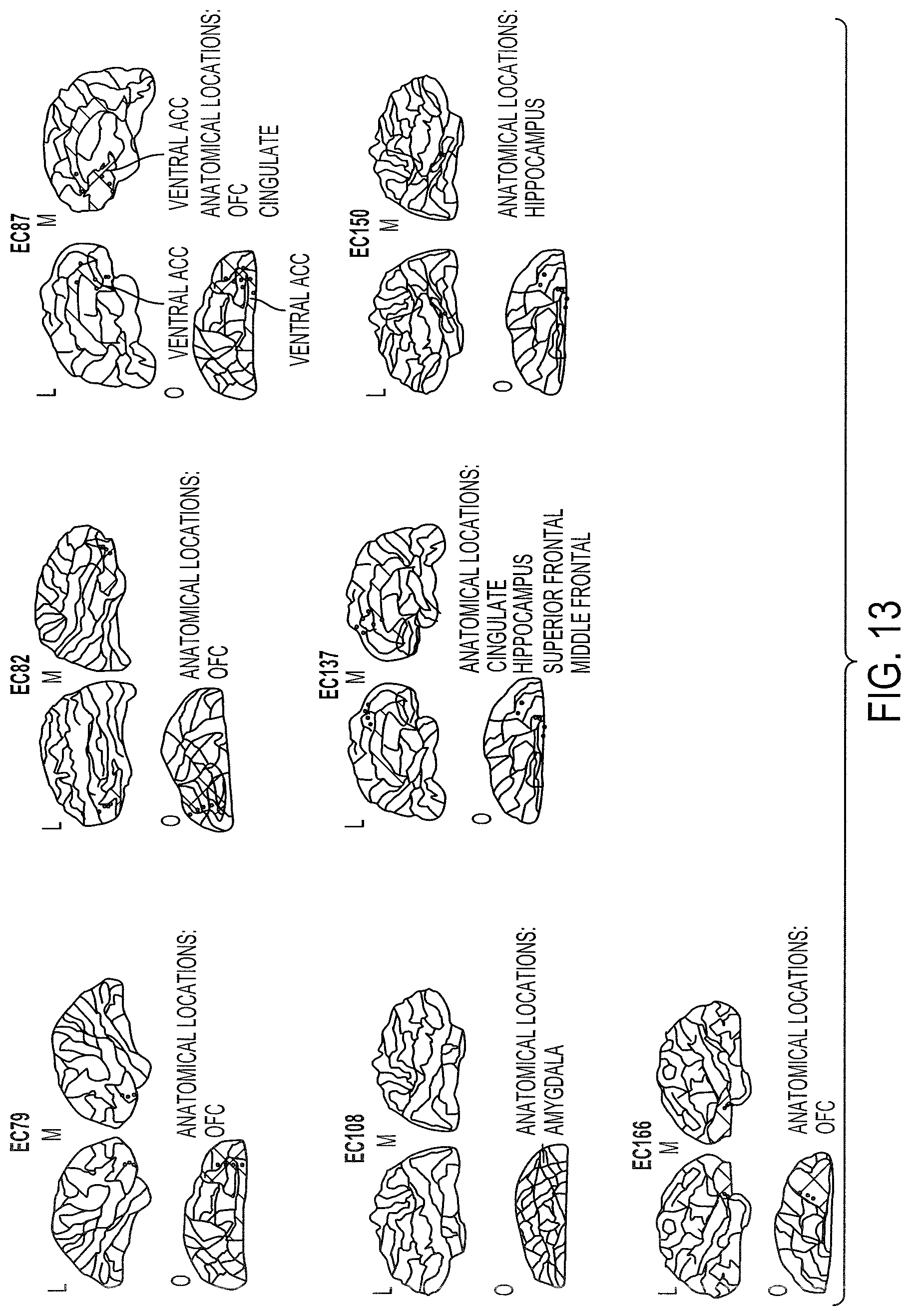 Patent US12097029 Figure 13 – Decoding neuropsychiatric states from multi-site brain network activity