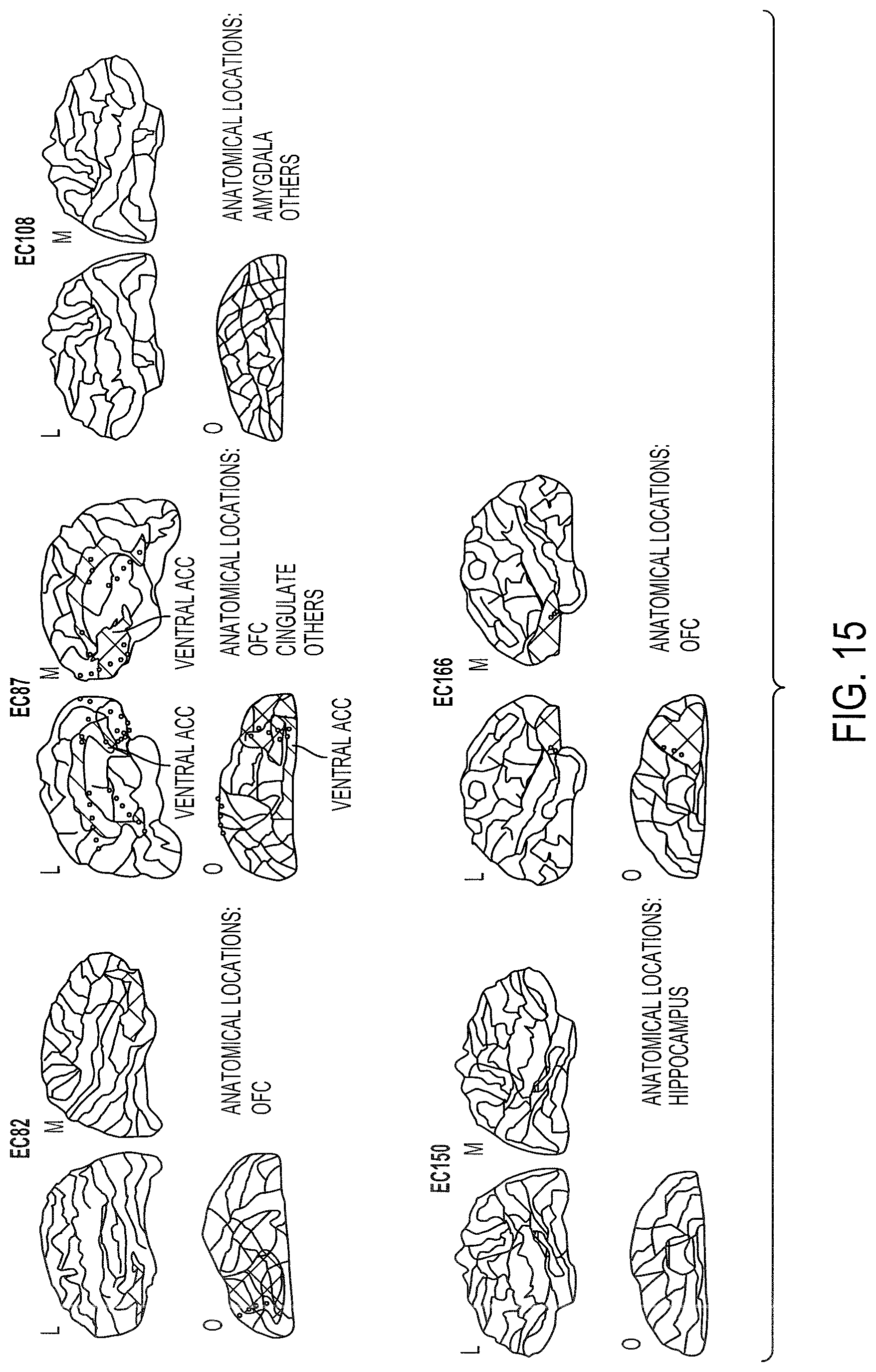 Patent US12097029 Figure 15 – Decoding neuropsychiatric states from multi-site brain network activity