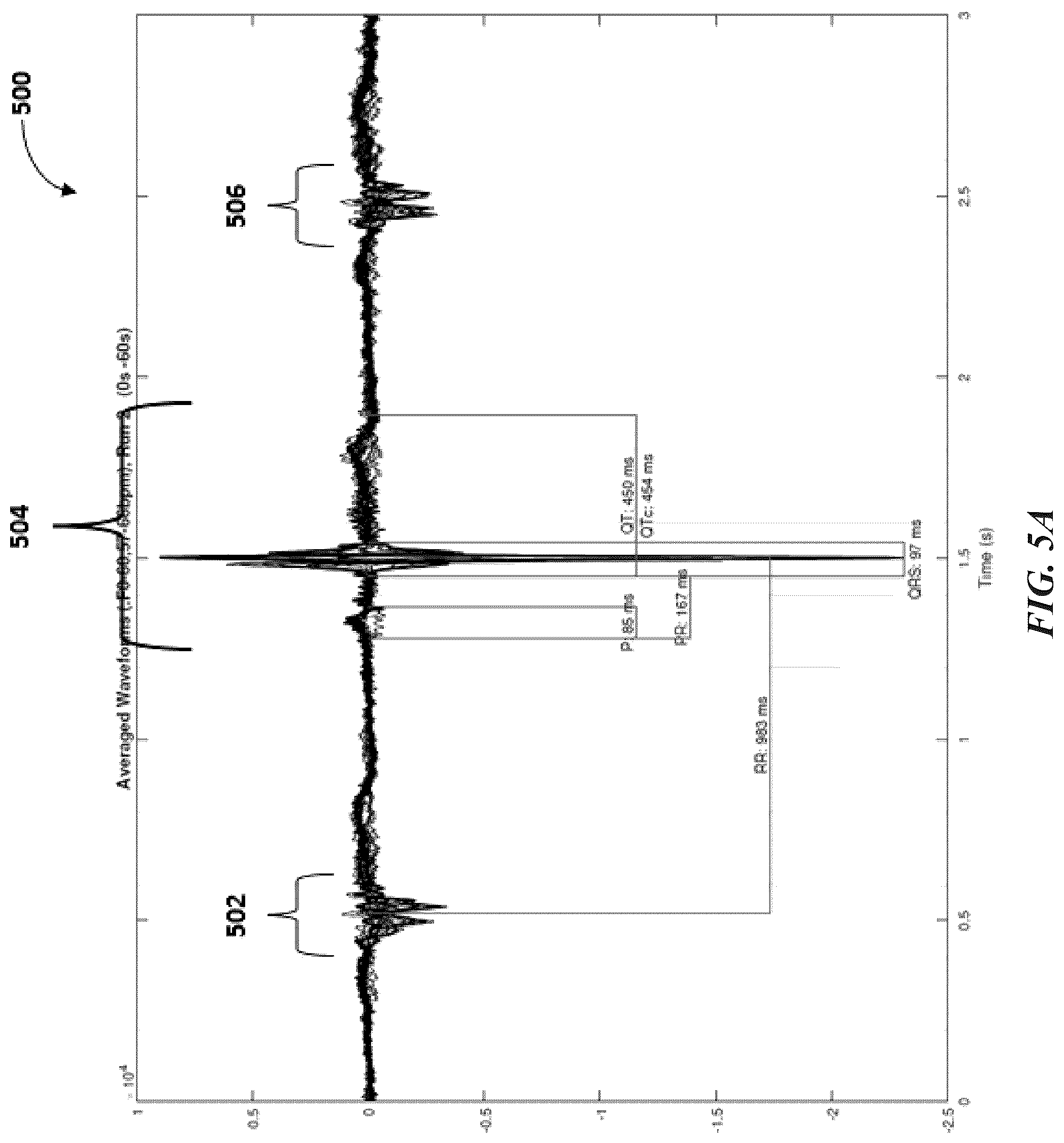 Patent US12097032 Figure 5 – Machine differentiation of abnormalities in bioelectromagnetic fields