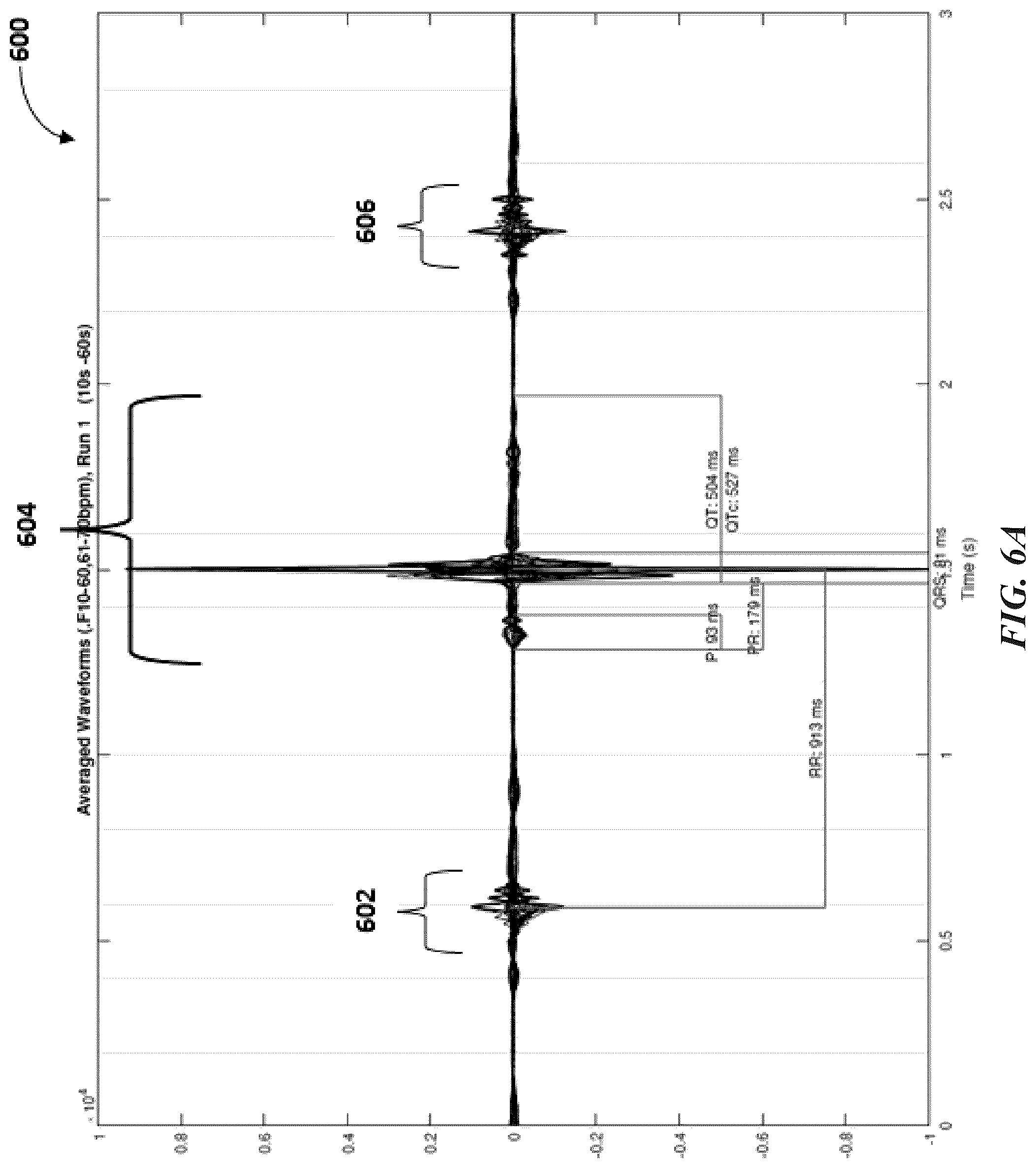 Patent US12097032 Figure 7 – Machine differentiation of abnormalities in bioelectromagnetic fields