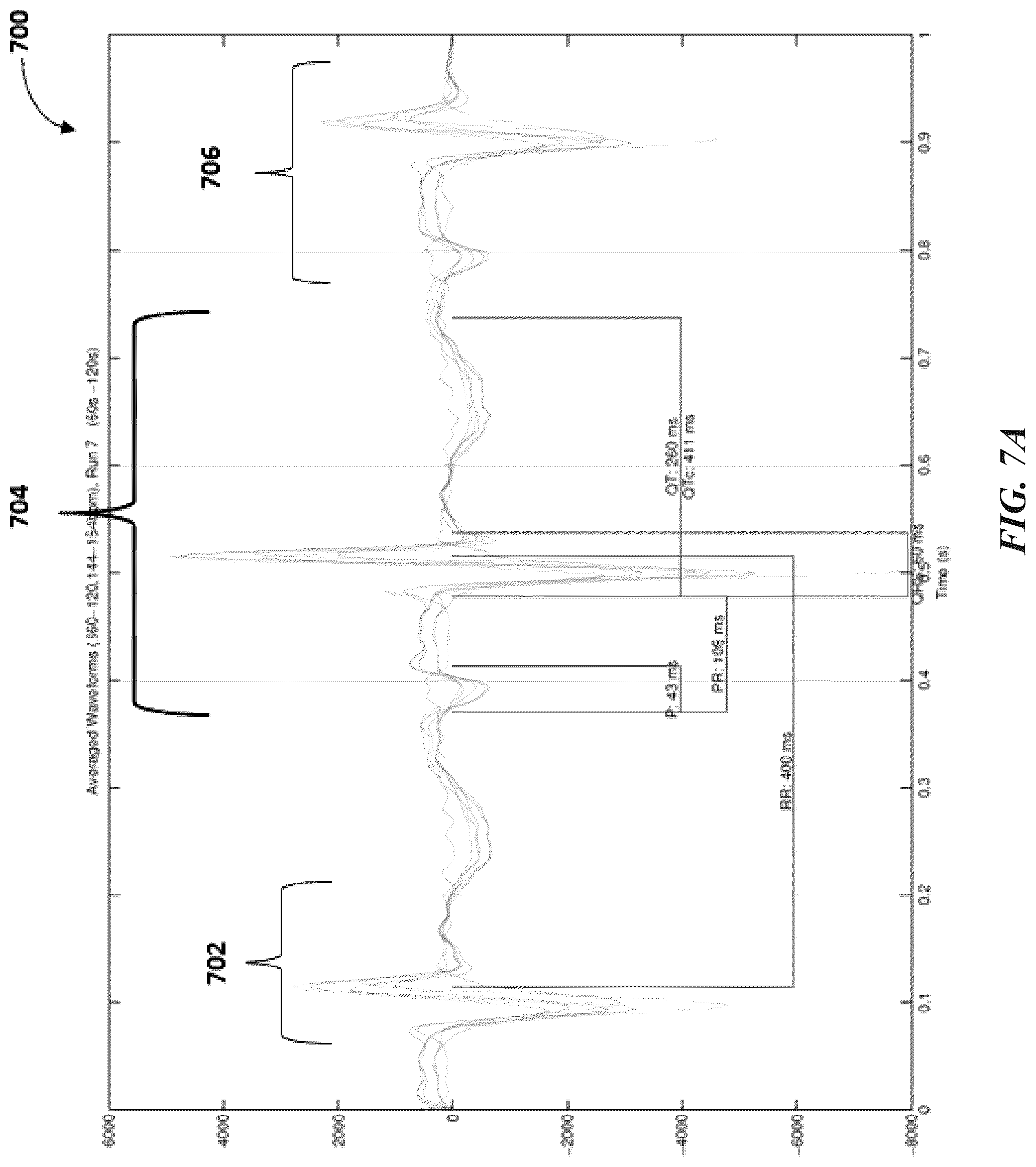 Patent US12097032 Figure 9 – Machine differentiation of abnormalities in bioelectromagnetic fields